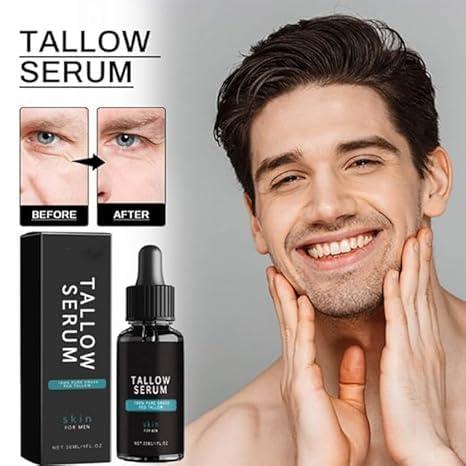 EEGCUPD Forge Wrinkle Defense Tallow Balm, Forge Beef Tallow Skin Care for Men, Forge Mens Face Care Set, 2024 New Skin Care for Men TallowMens Anti Wrinkles Anti Aging Facial Care Kit (1set)