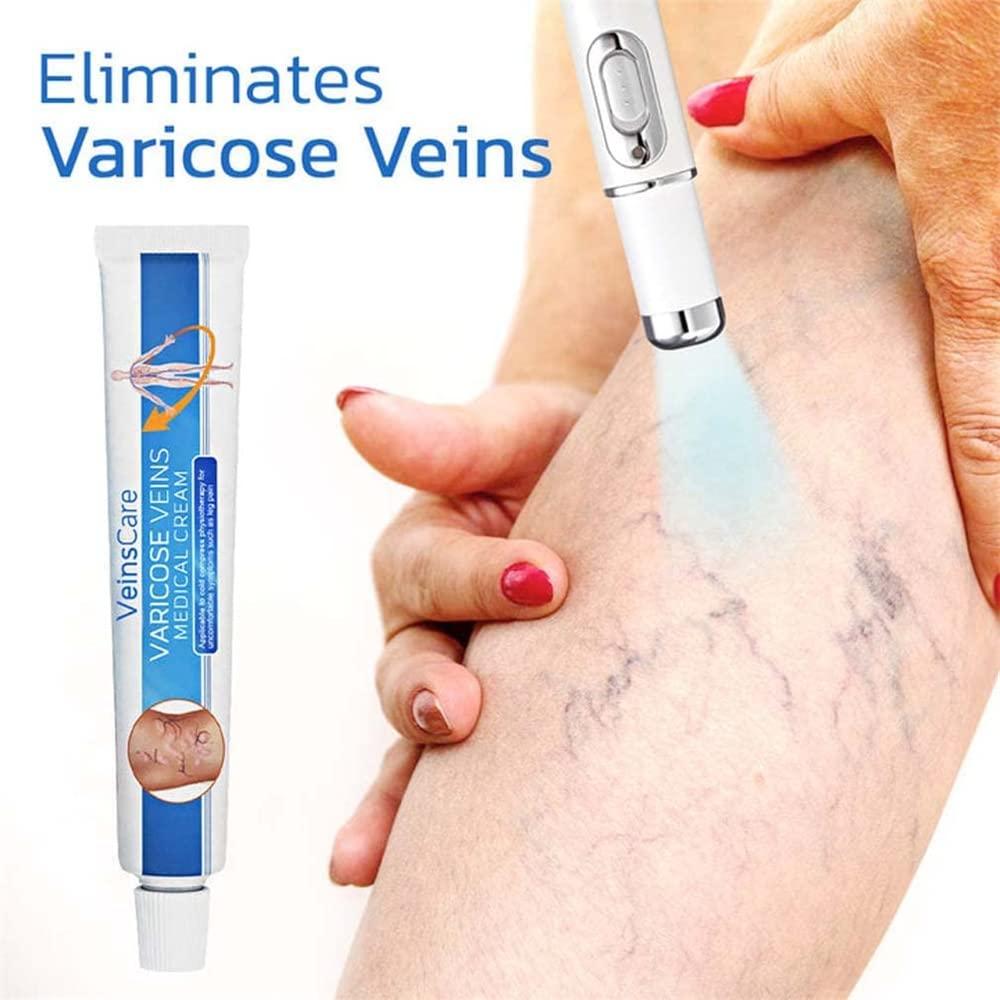 Nosbei Vericose Veins Treatment Blue Light Lazer Treatment Pen, Varicose Veins Blue Light Therapy Set, Blue Light Therapy Pen for Varicose and Spider Veins, Spider Vein Removal Lazer Pen (2cream+1pen)