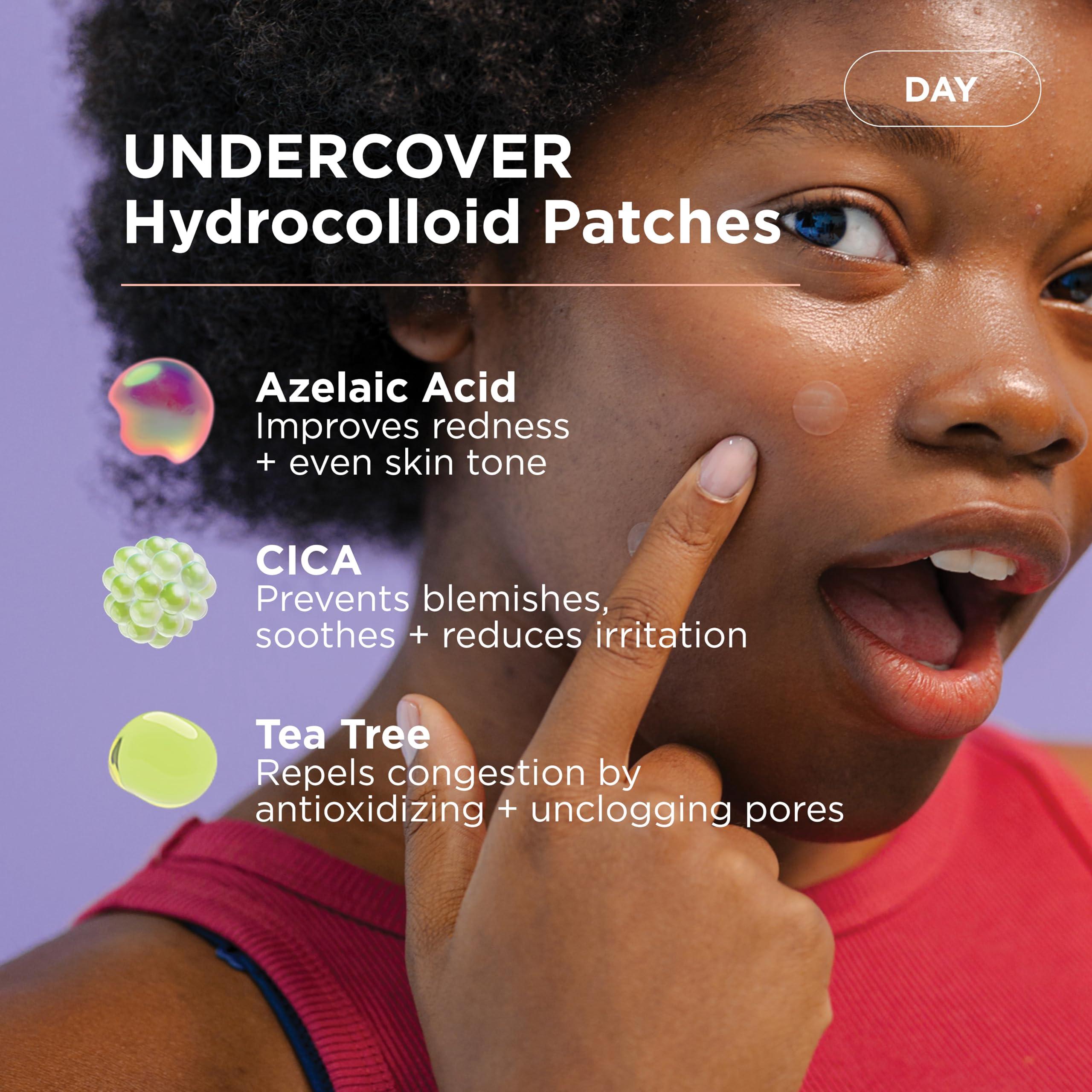 ZitSticka ZitSticka 24/7 Attack Bundle Acne Patches for Face - World\'s Most Potent Pimple Patch with Fast-Acting Microdarts - Starts Working within 2 Hours for Deep, Early-Stage Zits & Blemish - 14 Count