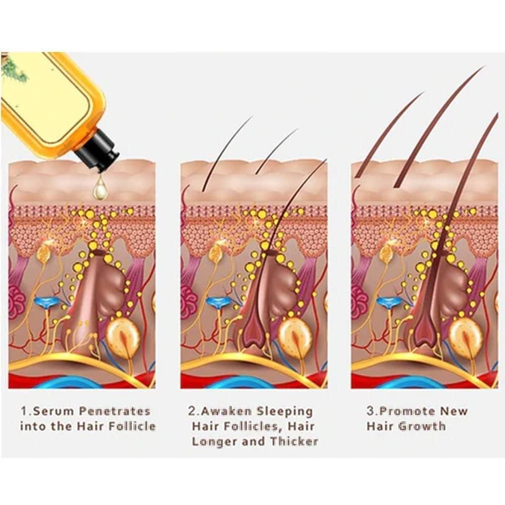 Lomnoeza Ginaday Instant Ginger Hair Regrowth Shampoo, Anti-Hair Loss (500ML/1PCS)