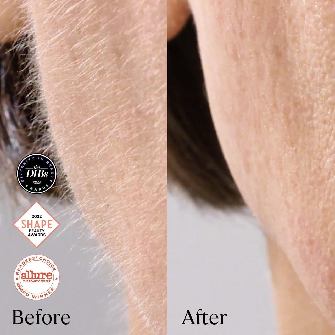 MICHAEL TODD Michael Todd Beauty - Sonicsmooth Pro+ Dermaplaning System with LED Light - 2 in 1 Women\'s Face Exfoliation & Peach Fuzz Hair Remover - 16 Dermaplaning Blades & 2 Microsmooth Microdermabrasion Tips