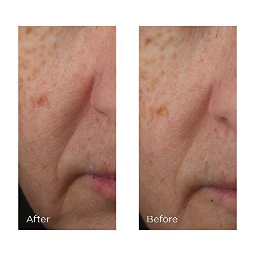 Perricone MD Perricone Md Cold Plasma Plus+ Advanced Serum Concentrate, 2 Oz