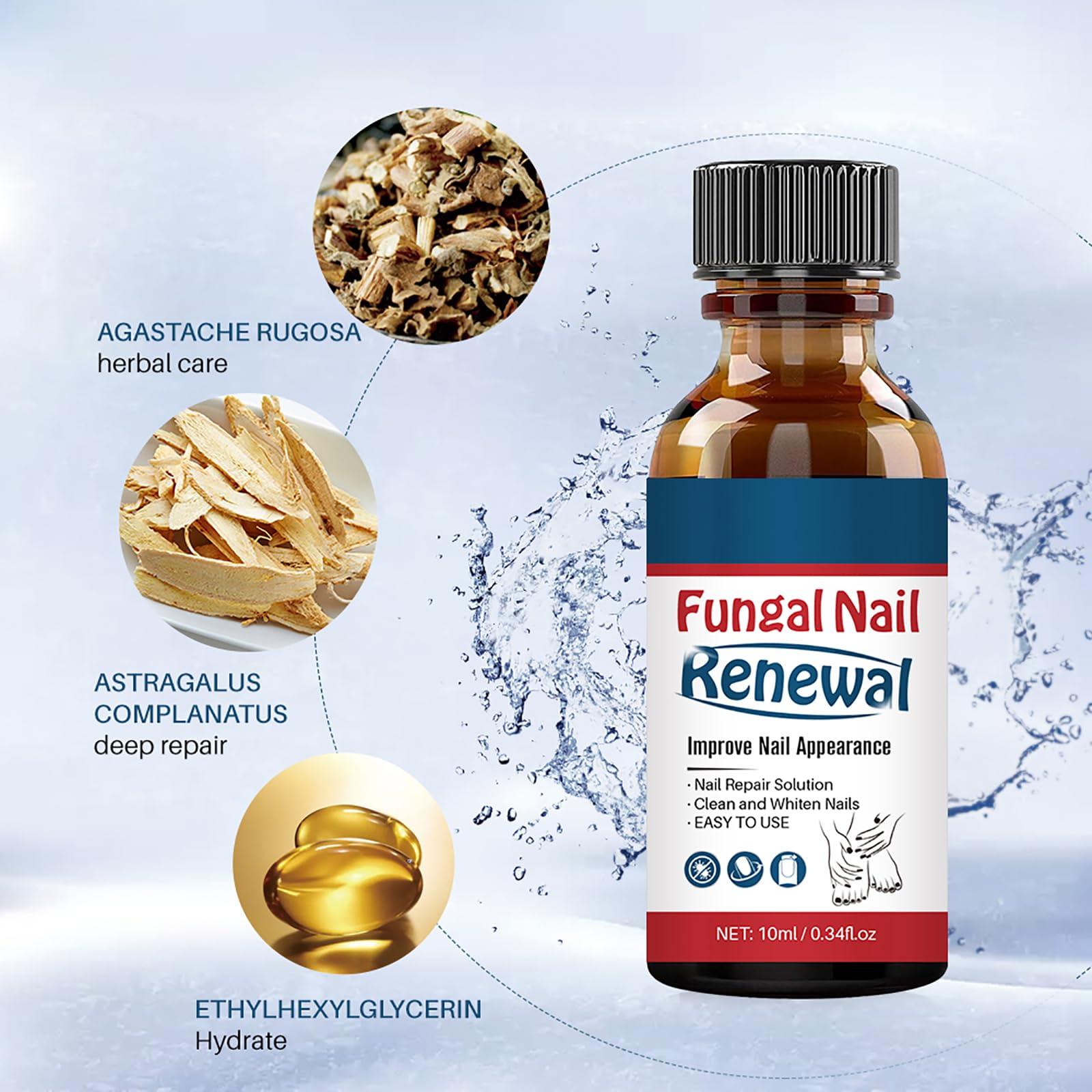 Easilydays Easilydays Nail Repair Essnce Liquid, Fingernail and Toenail Repair, Fix & Renew Damaged, Broken, Cracked & Discolored Nails, Reduce Nail Thickening, Strengthen Nails for Beautiful Nail