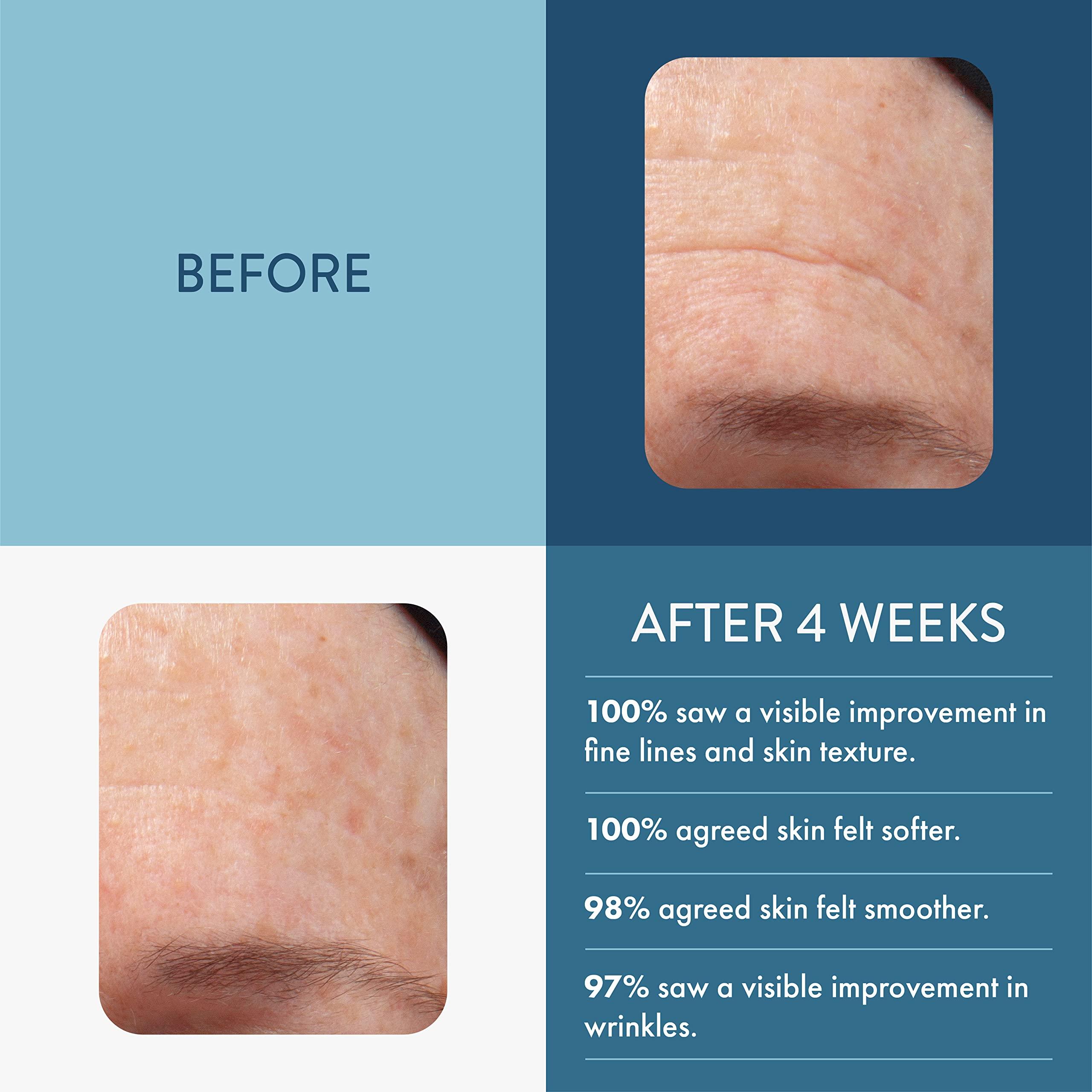 Lancer Lancer Skincare The Method Intro Kit, 3-Step Facial Exfoliator, Cleanser, and Moisturizer Kit for Oily or Congested Skin