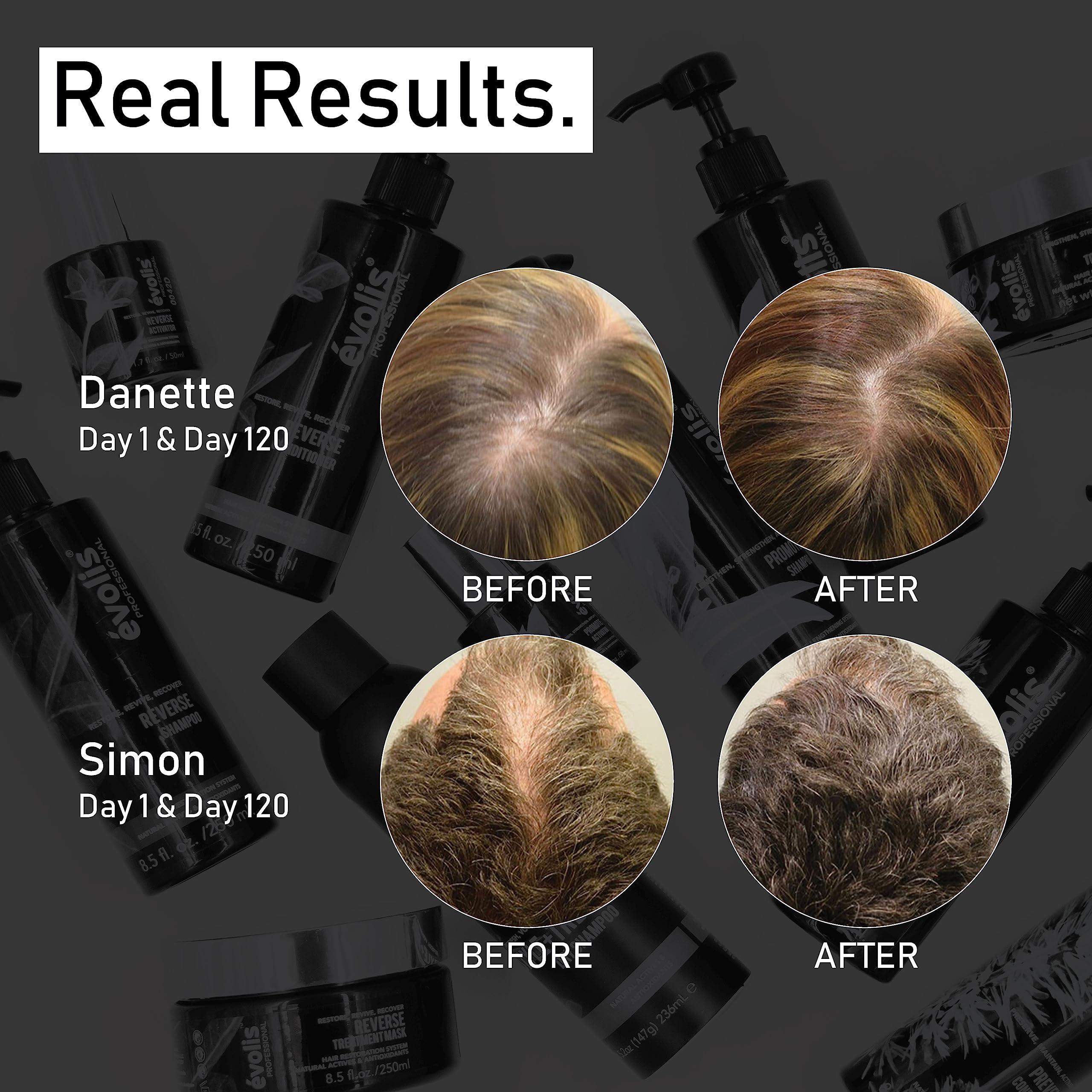 EVOLIS volis Prevent Anti-Aging Shampoo | Natural Anti Hair Loss Shampoo for Men and Women | Ideal for Sensitive, Dry Scalp and Oily Hair | Preventative Hair Loss Treatment (8.5 fl oz)