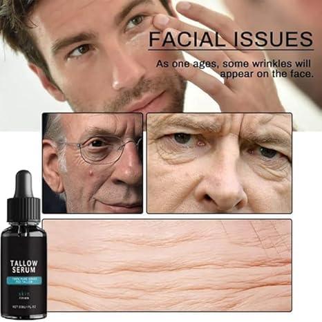 EEGCUPD Forge Wrinkle Defense Tallow Balm, Forge Beef Tallow Skin Care for Men, Forge Mens Face Care Set, 2024 New Skin Care for Men TallowMens Anti Wrinkles Anti Aging Facial Care Kit (1set)