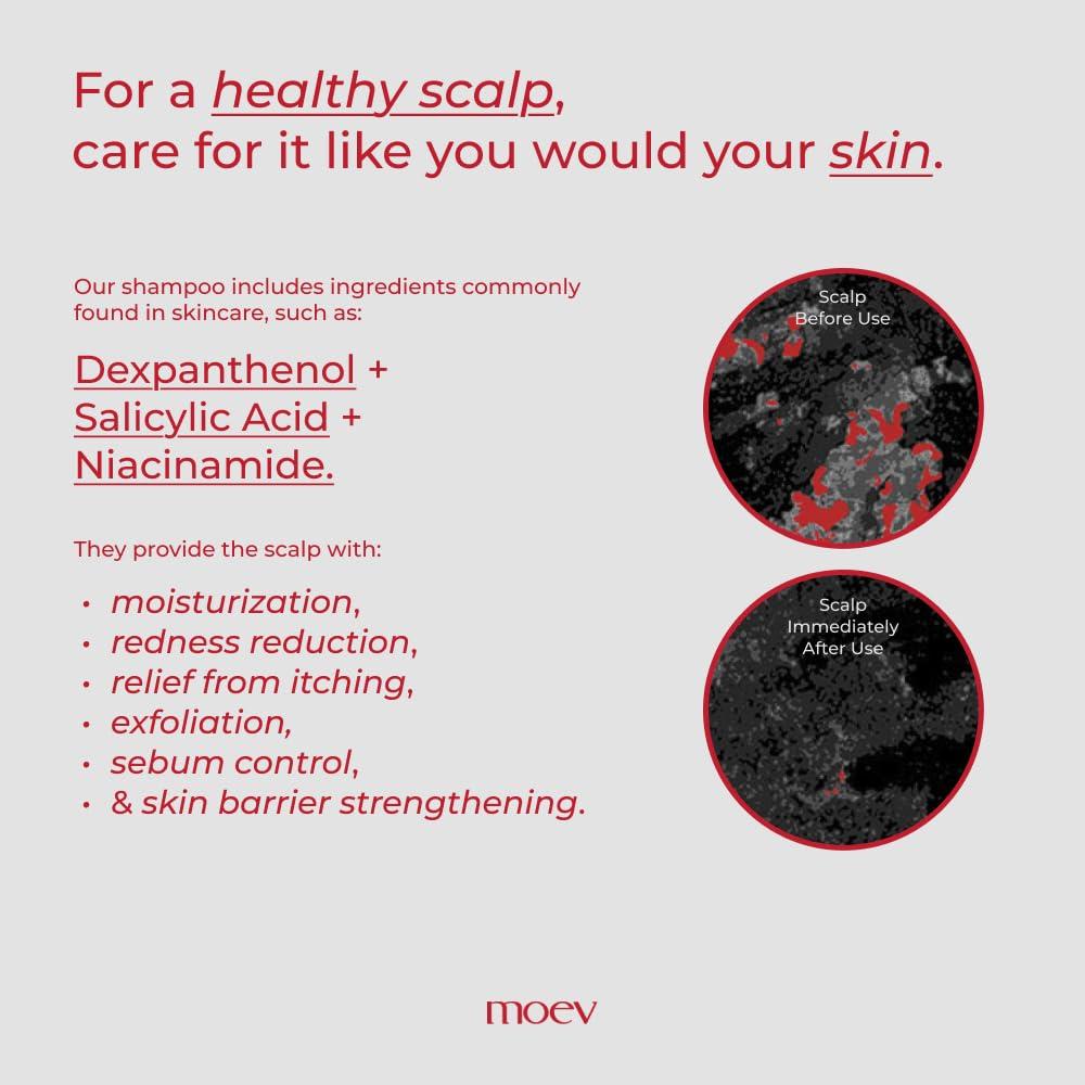 MOEV MOEV ANNURCATIN Shampoo, Biotin Hair Growth Volumizer Korean Anti Hair Loss Shampoo for Women, Build Lift, Natural Sulfate and Paraben-Free Apple Fresh Cleanser, Strengthens Weak Hair 10.14 fl.oz.