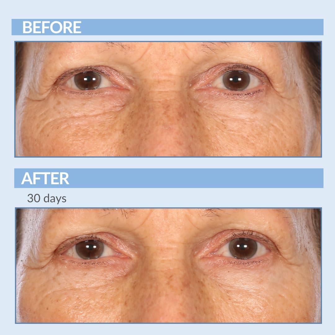 Serious Skincare Serious Skincare - Retinol Vitamin A Eye XR Under Eye Cream Concentrate - Reduce Fine Lines, Dark Circles & Puffiness - Daily Wrinkle Cream - Anti-Aging - Line Smoothing Skin Care Treatment - 0.5 oz