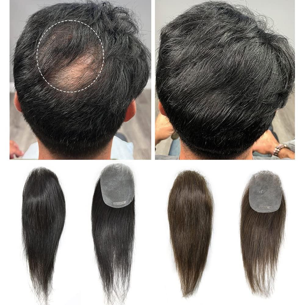 Right Hair Bald Spot Hair Patch For Men V-Looped Remy Human Hair Patch For Bald Spot Natural lookimg Hair Replacement Unit Thin Skin Hair Piece for Bald Spot Hair Systems (#2 DARKEST BROWN, 4cm X 8cm - 6 INCH)