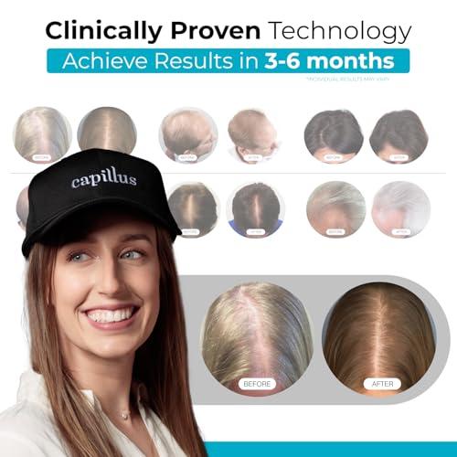 Capillus Capillus Plus Mobile Laser Therapy Cap for Hair Regrowth, with 202 Red Light Lasers for Laser Hair Growth, Red Light Hair Growth
