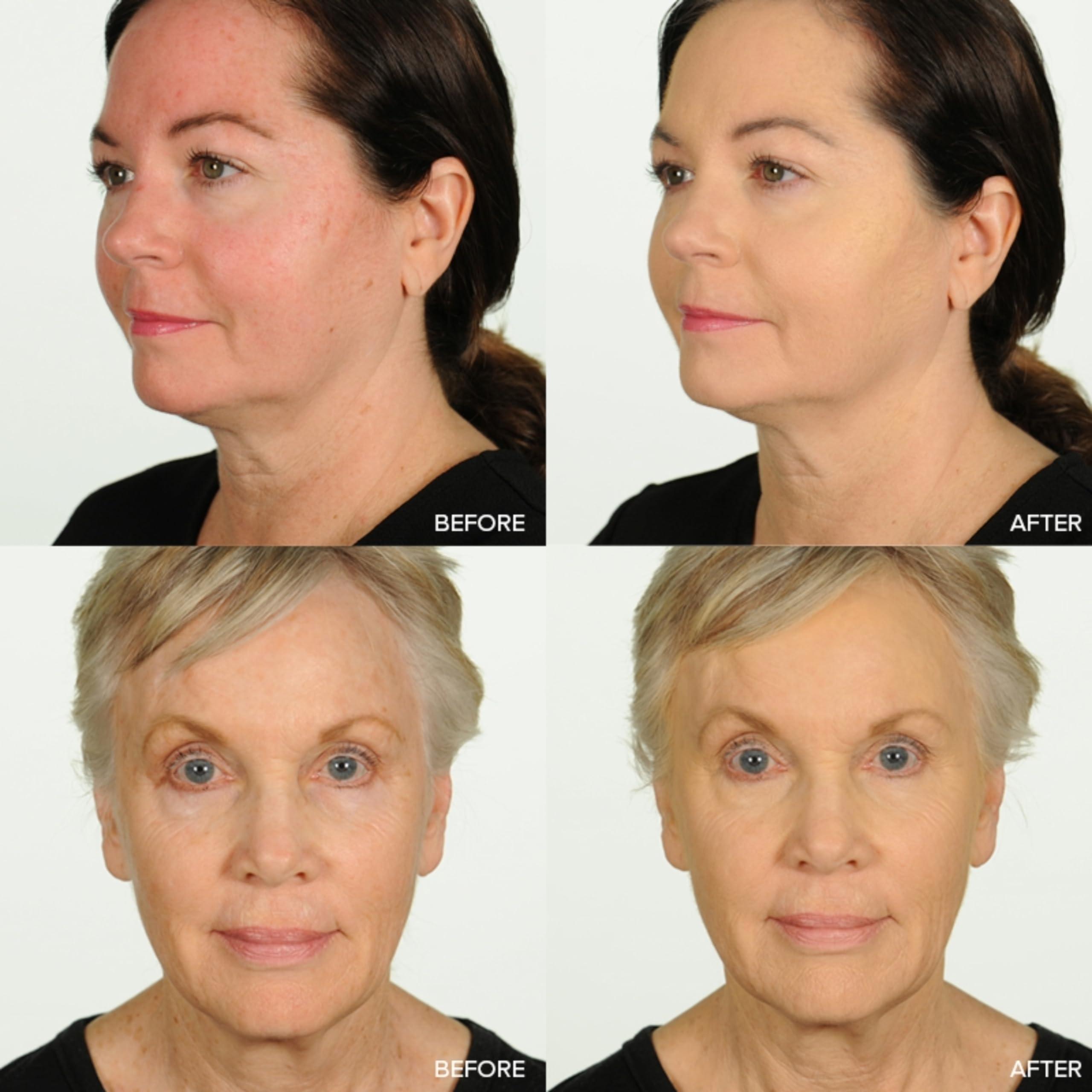 TEMPTU TEMPTU Perfect Canvas Airbrush Foundation Complete Starter Set & Airpod Pro 3-Pack Cartridge Bundle