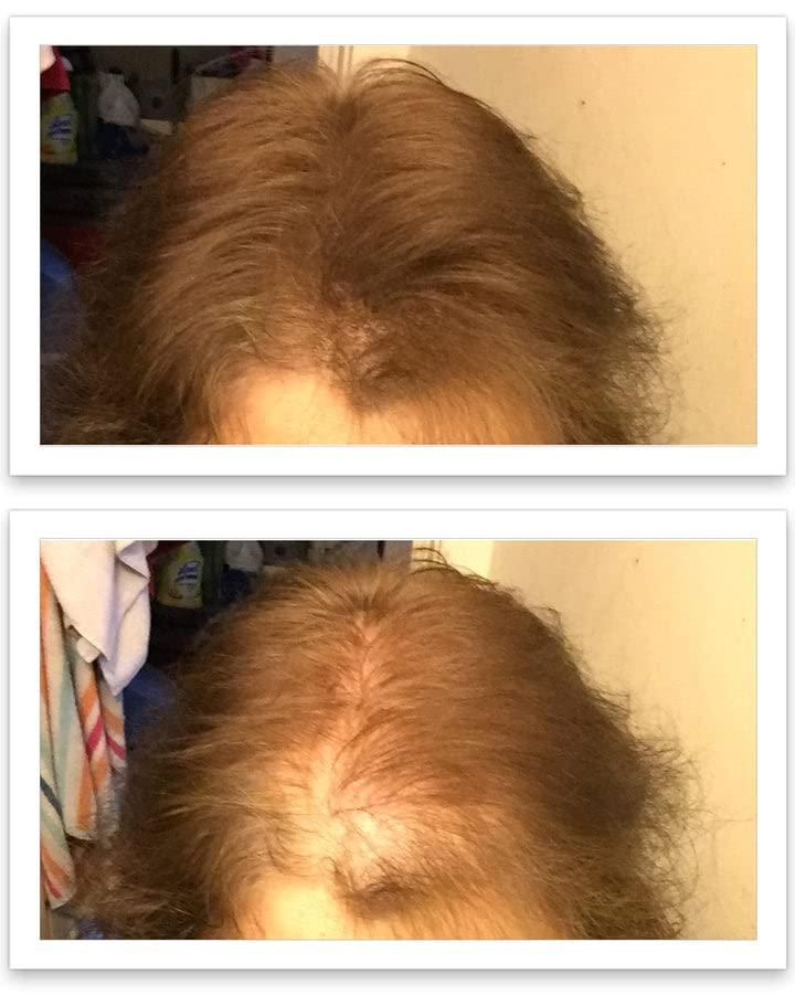 Caboki Caboki All-Natural, Plant-Based Hair Building Fiber. Hair Loss Concealer. Covers Bald Spot and Thinning Hair. (16G, 40-Day Supply) (Medium Brown)