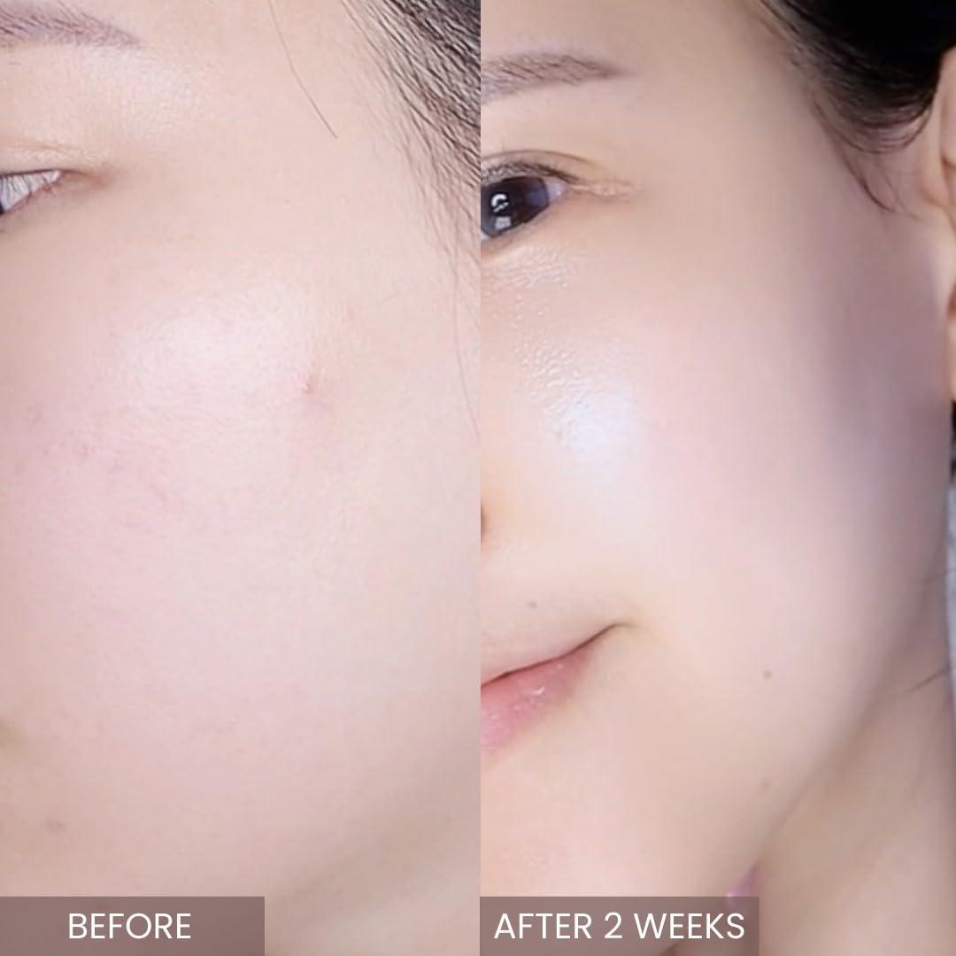 aplin aplin Pink Tea Tree Intensive Cream - 50g/Skin Moisturizer/Facial Moisturizers/1.7 Oz, CICA, Allantoin, Korean Skin Care, Moisturizer, Hydrating