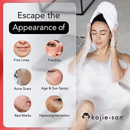 Kojie San, Skin Science Kojie San Skin and Body Soap Original Kojic Acid, Dark Spot Remover Soap Bar with Coconut & Tea Tree Oil 3 x 65g Bars