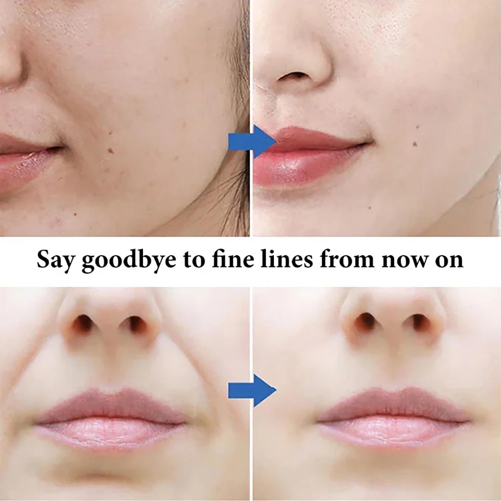 AAVEDA Microcrystalline Nasolabial Folds Removal Mask, Microcrystalline Eye Pattern Wrinkle Remover Patch, Face Wrinkle Removal Lift Mask,For Reduce Fine Lines (2box10pcs)