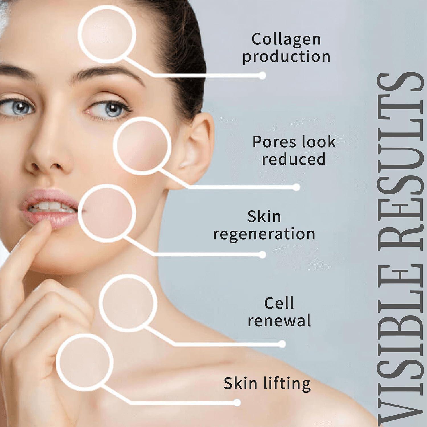 Newliky Pdo Threads for Face Lift Mono Screw Type (29G50MM) Smoothing Wrinkles PDO Thread Lift for Whole Body with Sharp Tip 20pcs