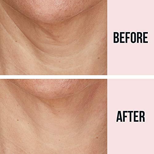 SiO SiO Beauty NeckLift | Neckline Anti-Wrinkle Patch | Overnight Smoothing Silicone Patches For Neck Wrinkles, Fine Lines And Turkey Neck