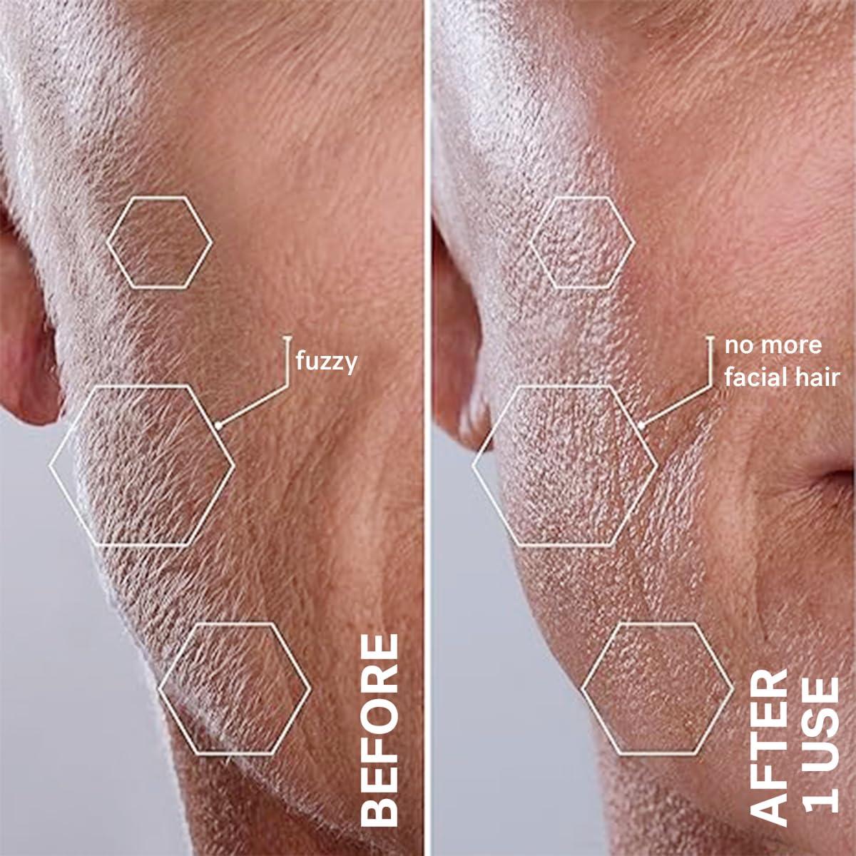 MICHAEL TODD Michael Todd Beauty - Sonicsmooth Pro+ Dermaplaning System with LED Light - 2 in 1 Women\'s Face Exfoliation & Peach Fuzz Hair Remover - 16 Dermaplaning Blades & 2 Microsmooth Microdermabrasion Tips