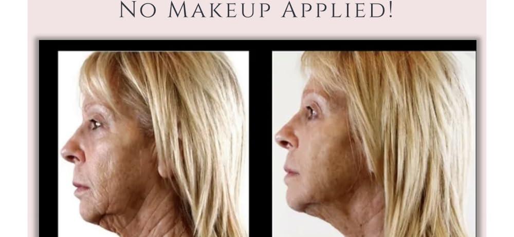 Dr.Sevinor Skincare Solutions Dr Sevinor Wrinkle Solution Smoothing Tinted Serum and Dr. Sevinor\'s Facelift Solution Concentrated Serum Revitalizes Tired Looking Skin, Diminishes Wrinkles/Lines. Combo Special SAVE 10%