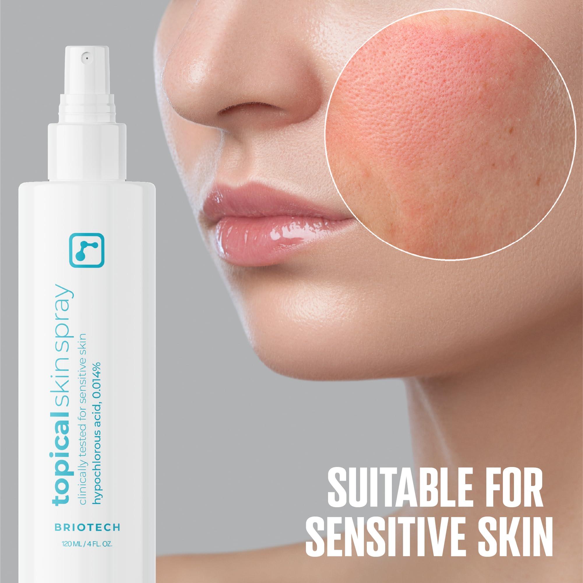 BRIOTECH BRIOTECH Topical Skin Spray, Hypochlorous Acid Spray for Body & Face, Eyelid Cleanser, HOCl Facial Mist, Support Against Irritation, Calm Redness, Soothe Scalp, Packaging May Vary, 4 oz ea, 2 ct