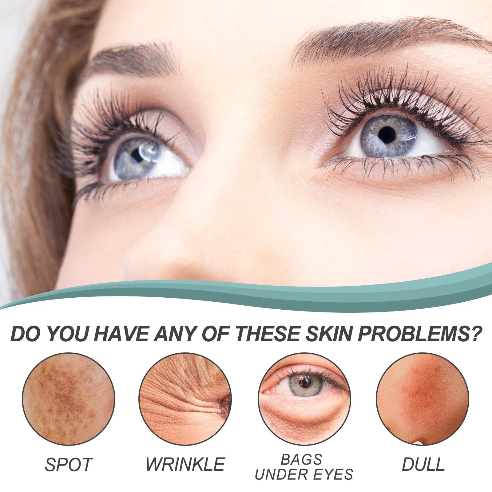 generic Dark Spot Remover for Face And Body, Dark Spot Remover (1)