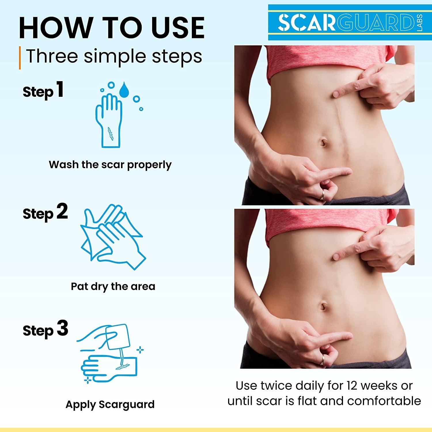 ScarGuard Scarguard Repair Liquid with Vitamin E 0.5 oz ( Pack of 2)