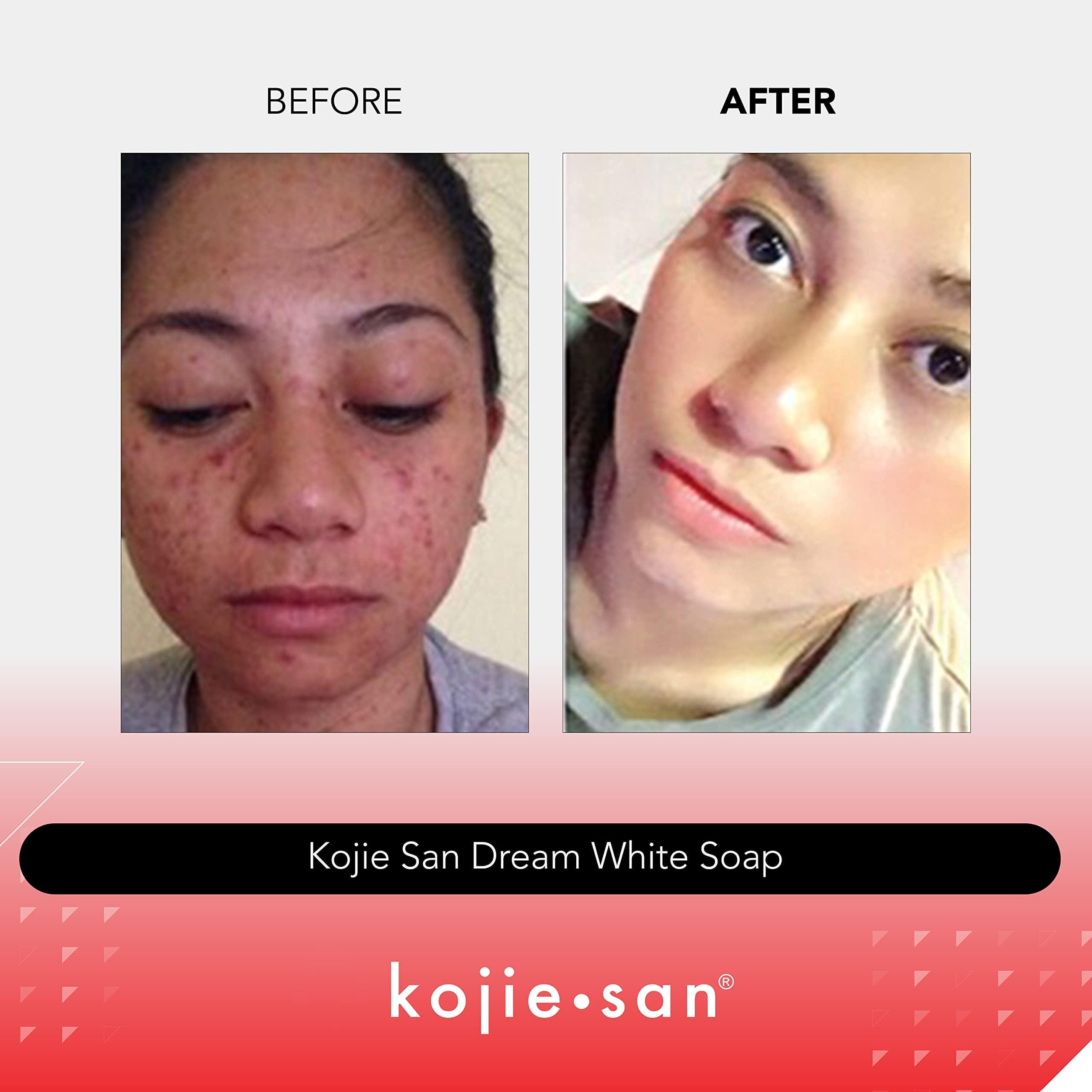 Kojie San Kojie San Dream White Soap - Skin Brightening Kojic Acid Soap with Collagen, Elastin & Coconut Oil - 135g x 2 Bars
