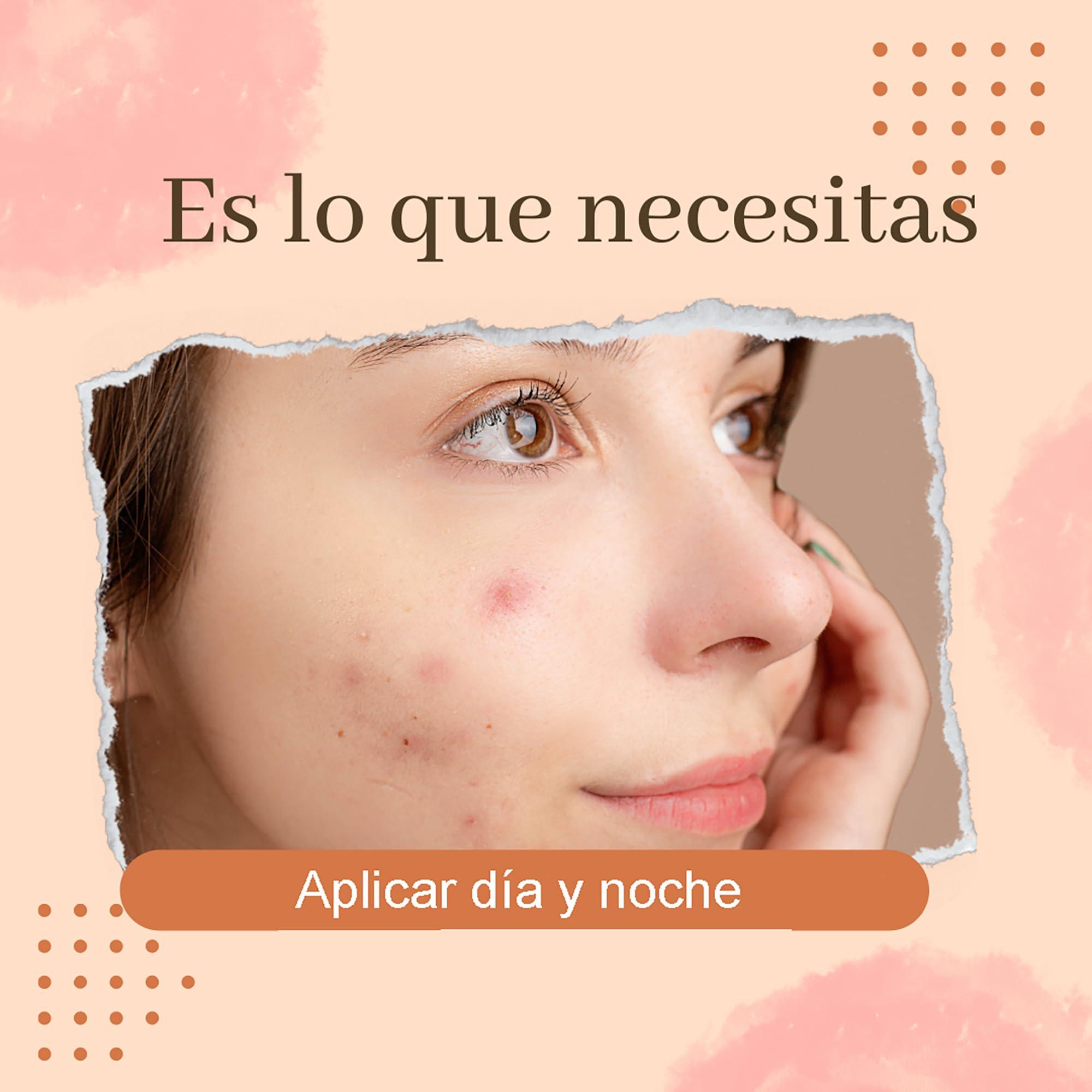 Bella Piel PINK MOSQUETTE ANTI-ACNE CREAM