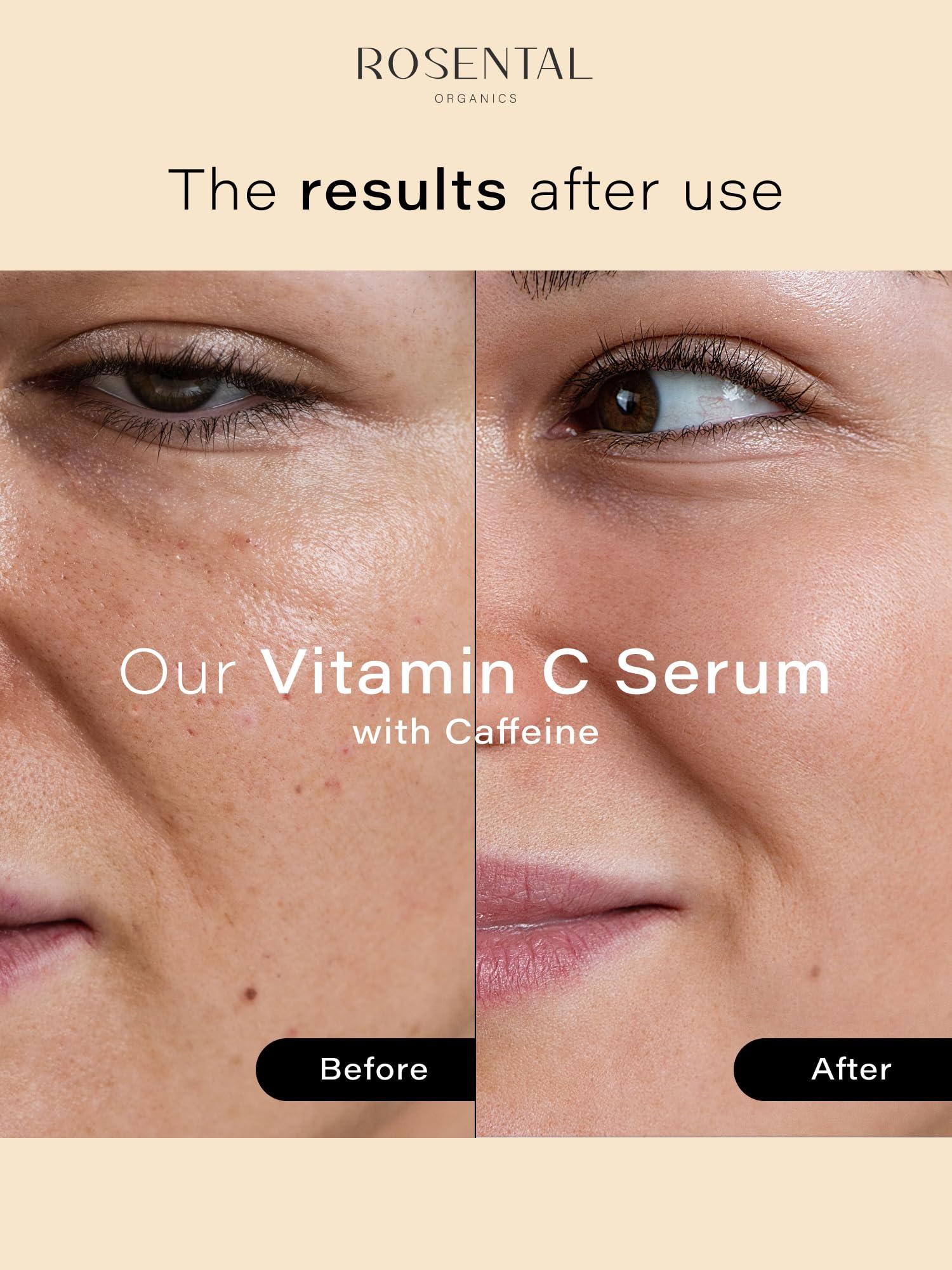 Rosental Rosental Organics Vitamin C Serum with Caffeine (30ml) - Hydrating Facial Serum - Against dark pigment spots and acne scars - Wrinkles - Brightening facial care - Natural Cosmetics - Made in Germany