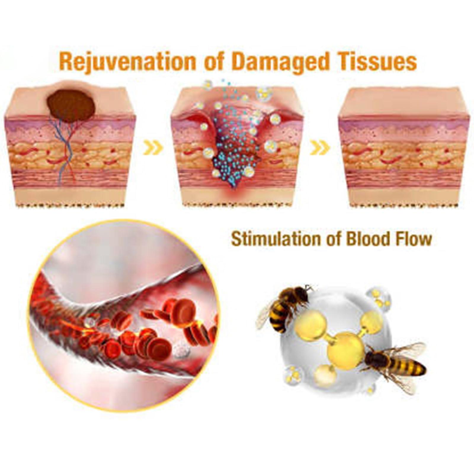 flysmus flysmus Bee venom Removal Marks Cream, Bee Venom Repair Cream, Bee Venom Removal Cream - All Skin Types (4PCS)