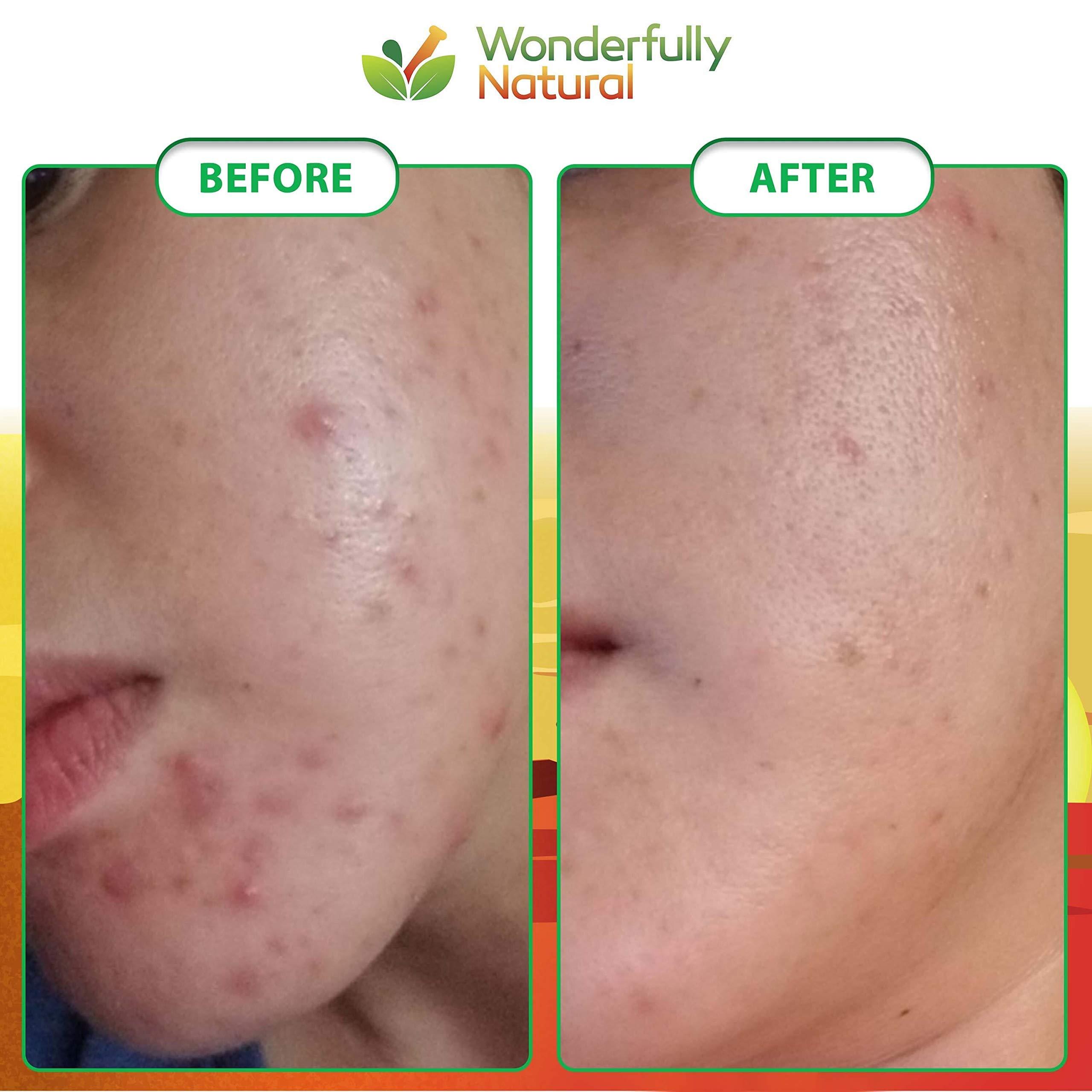 Wonderfully Natural Organic African Black Soap - For Acne & Dark Spots | Natural Vegan and Cruelty Free Satisfaction Guarantee 1lb bar | 90 day Supply