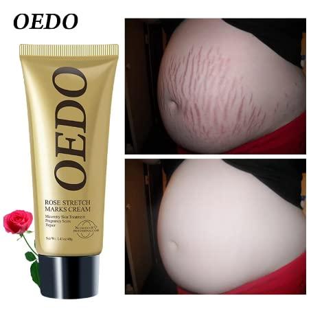 OEDO OEDO Rose Remove Stretch Mark Cream Nourish Anti-wrinkle Pregnant Women Skin Repair Remove Obesity Tattoo Body Care 40g