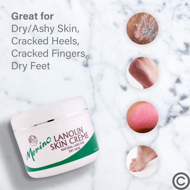 Merino Skin Care Dry Skin Lanolin Cream for Cracked Heels, Elbows and Soft Hands (500g/17.63 oz) Large Jar