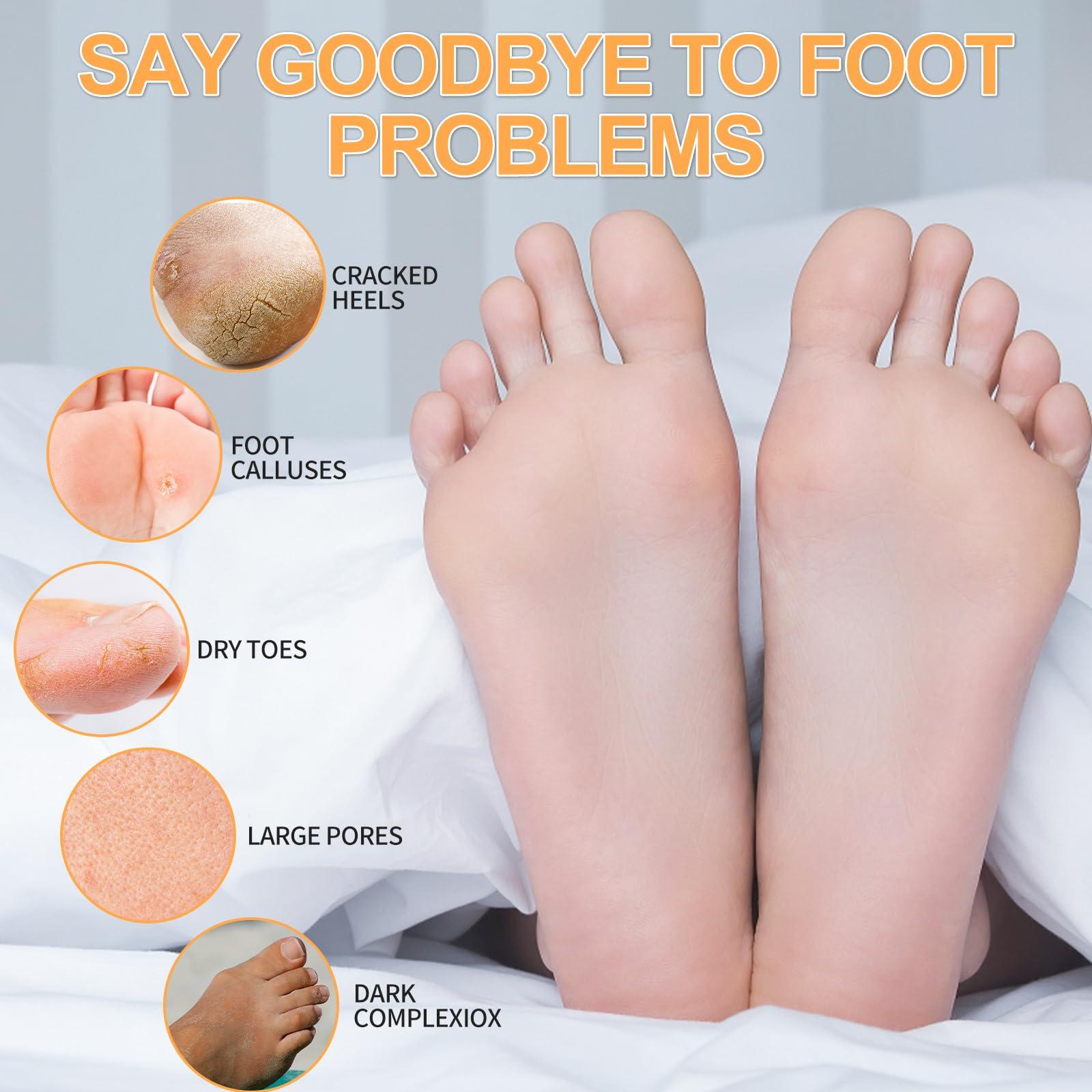 nbc BeautiLab nbc BeautiLab Pedicure Kit Foot Soak Set: Bubble Salt, Sugar Scrub, Massage Mask, Massage Lotion in a Box, 4 Step Foot Spa Kit for Dry Feet, Calluses and Tired Feet(1 Set Tropical Fruit)