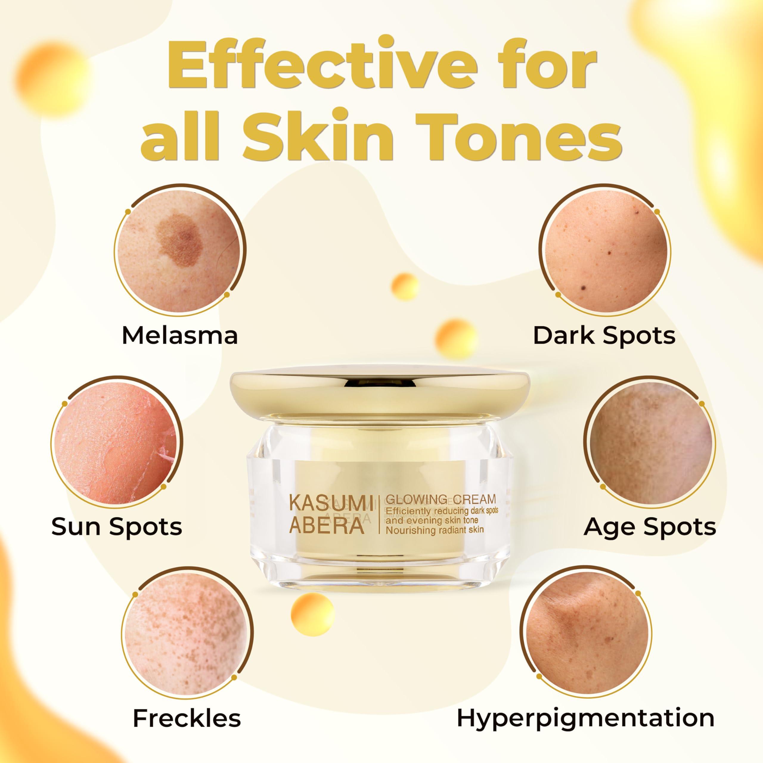 ABERA ABERA Tr Nm Kasumi, Kem M Tn Nhang, Dng Trng Da Cao Cp Nht Bn, Gim i Mi, Melasma Treatment For Face (0.7 Oz Per Item)