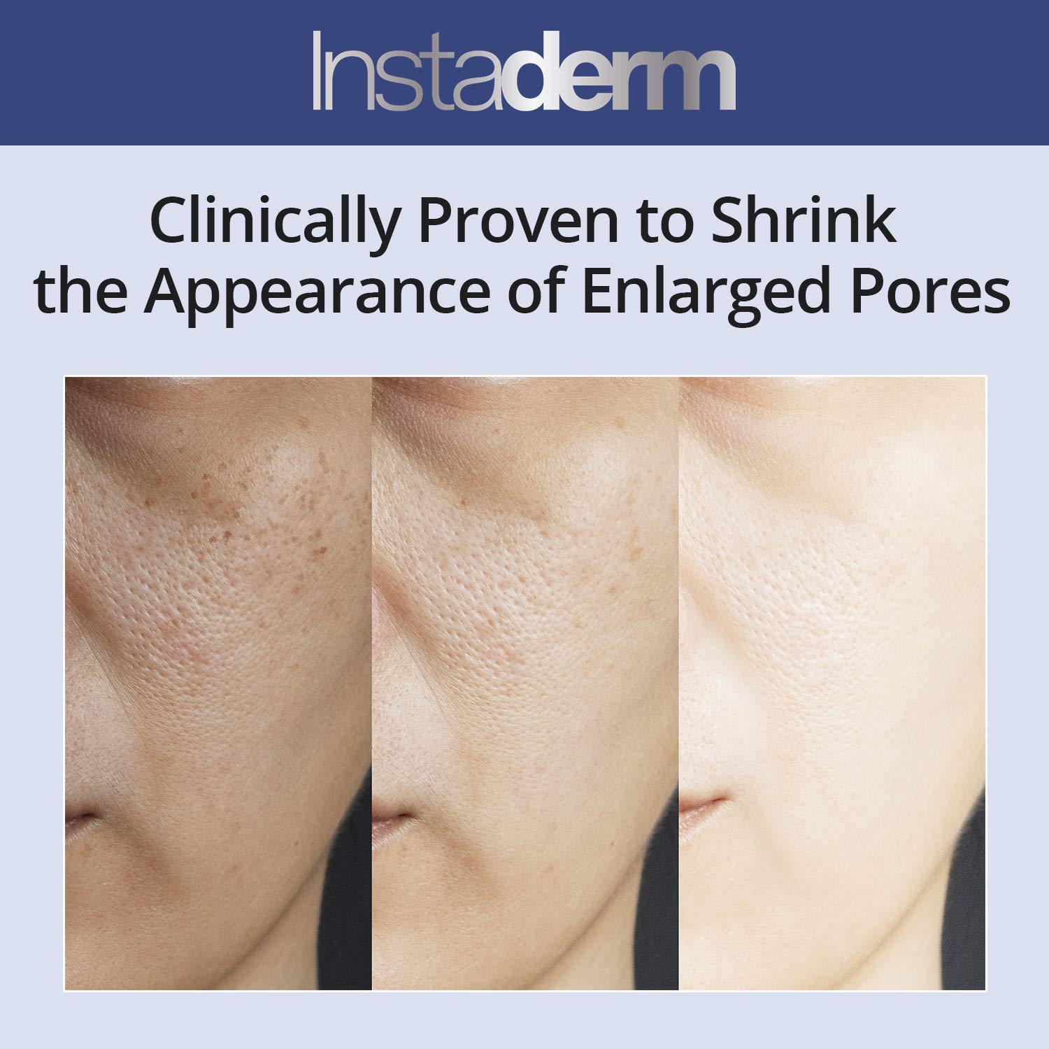 Instaderm Anti-Aging Exfoliating Peel Pads Smooths Fine Lines, Wrinkles, Dark Spots & Skin Roughness to Enhance the Skins Texture & Tone for Radiant Glow.