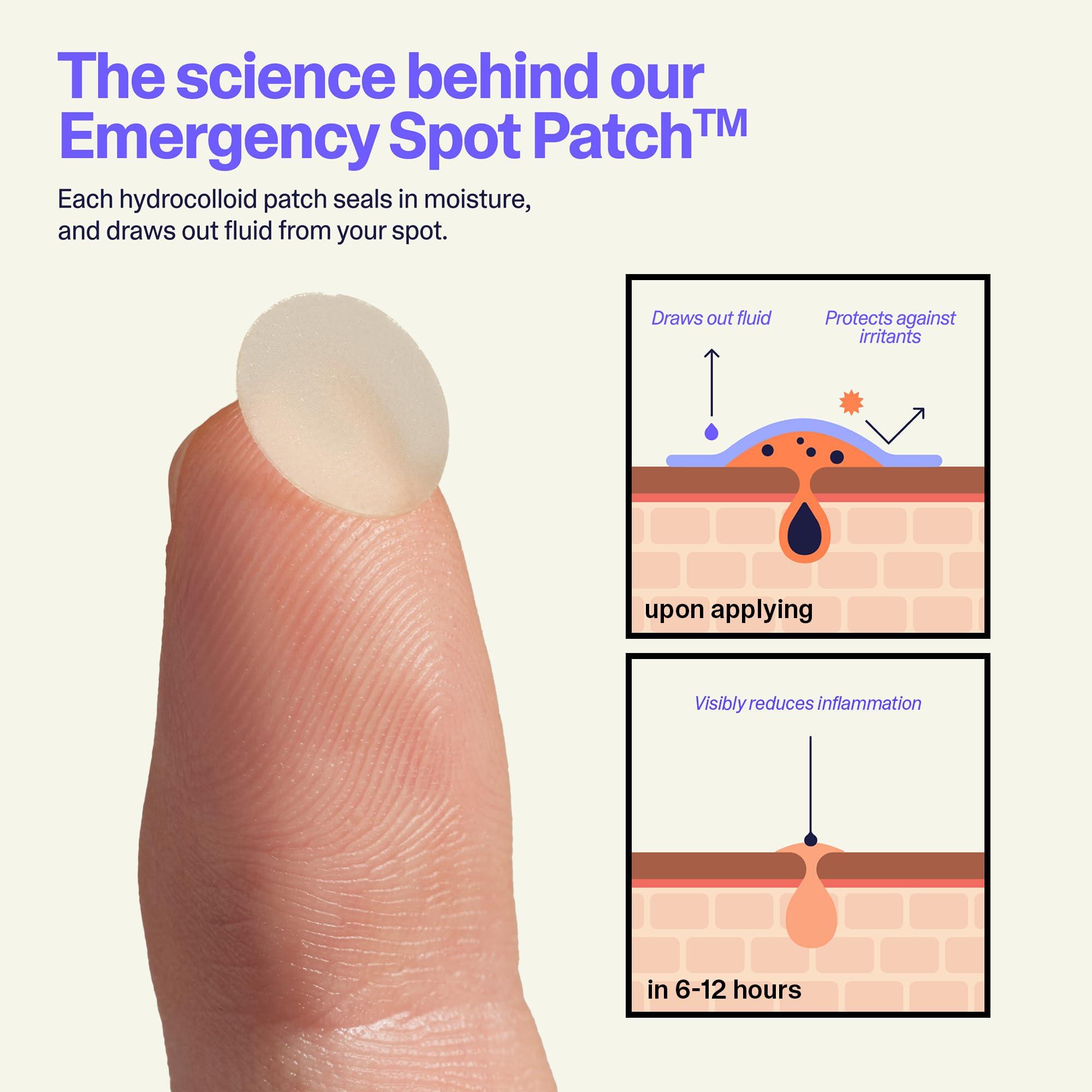 Curology Curology Emergency Spot Pimple Patches for Face, Hydrocolloid Pimple Patches Fast-Acting Support, Spot Concealing and Oil Absorbing, 40 Count