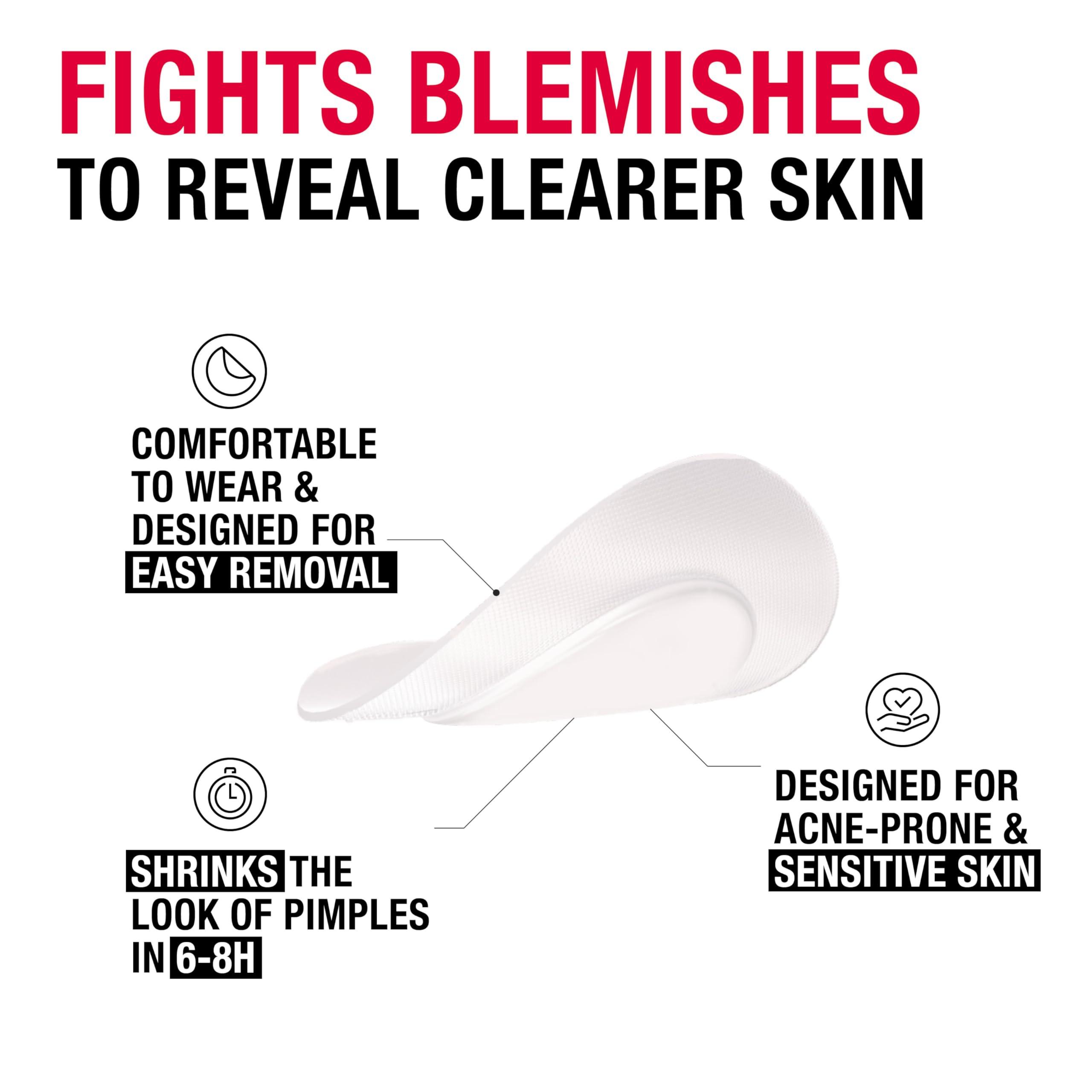 Neutrogena Neutrogena Pimple Patches for Sensitive Skin Variety Pack, Hydrocolloid Blemish Acne Patches Shrink the Look of Pimples & Zits Overnight, Gentle, Non-Medicated Facial Patches, Two Sizes, 30 ct