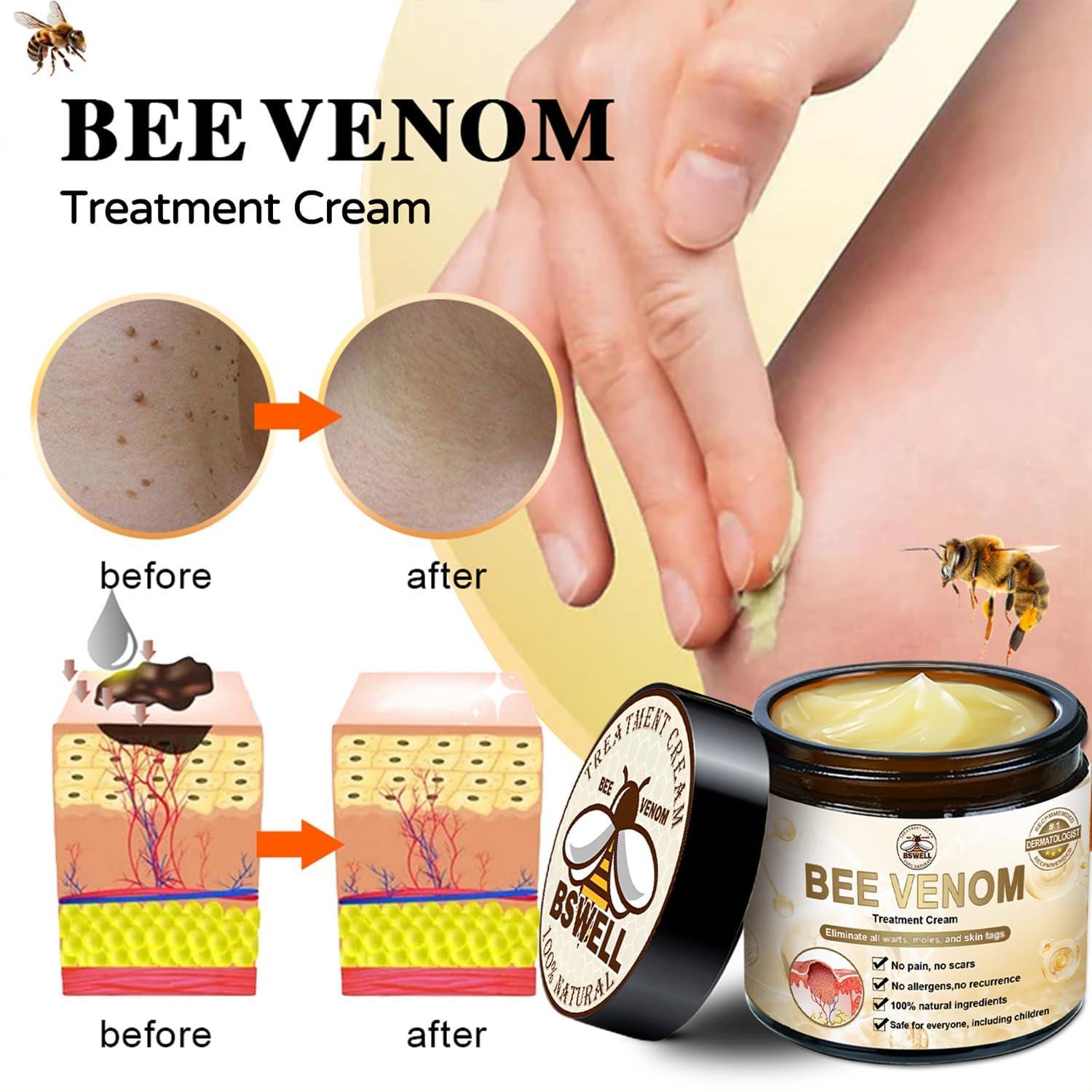 flysmus Bee Venom Skin Treatment Cream, Bee Venom Cream - 50ml, Bee venom Therapy Cream for All Skin Types (2PCS)