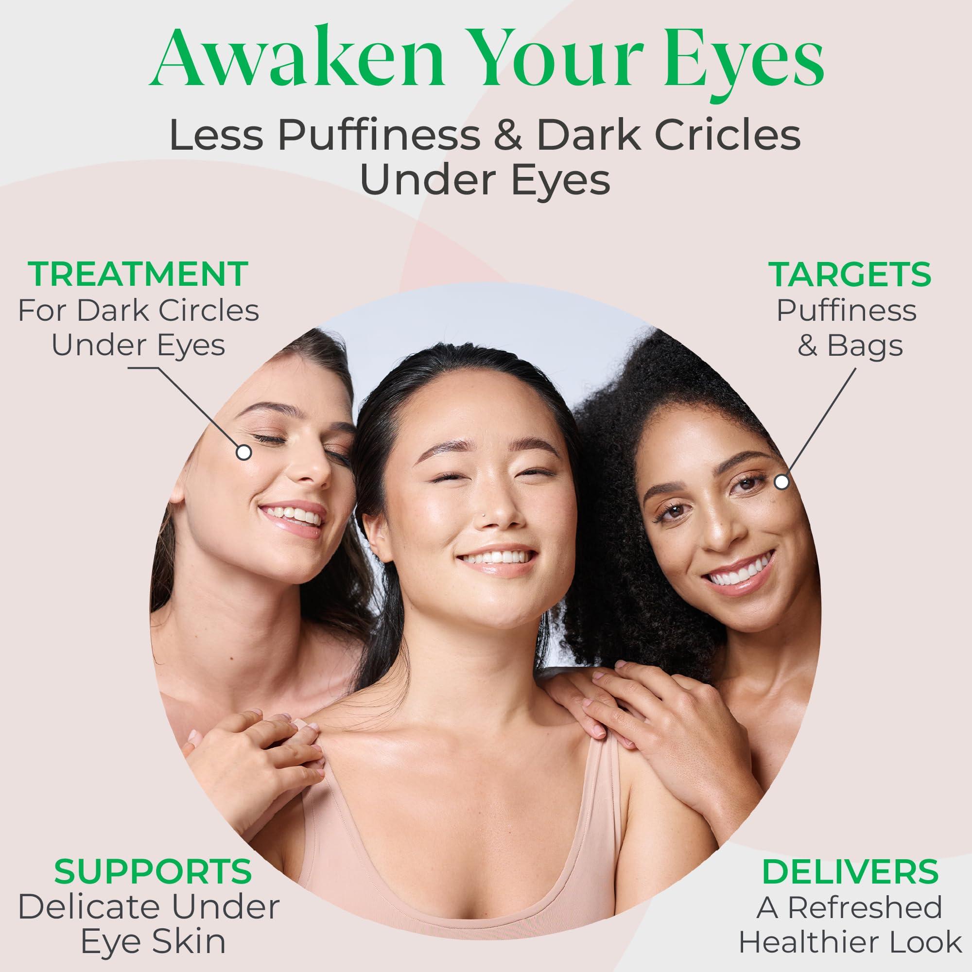 Skinqore Clinicals EyeGLO Caffeine Eye Cream for Dark Circles, Eye Bags, and Puffiness | UnderEye Treatment for Women with Peptides, Antioxidants, Hyaluronic Acid | Natural Brightening EyeCream - 1 Oz