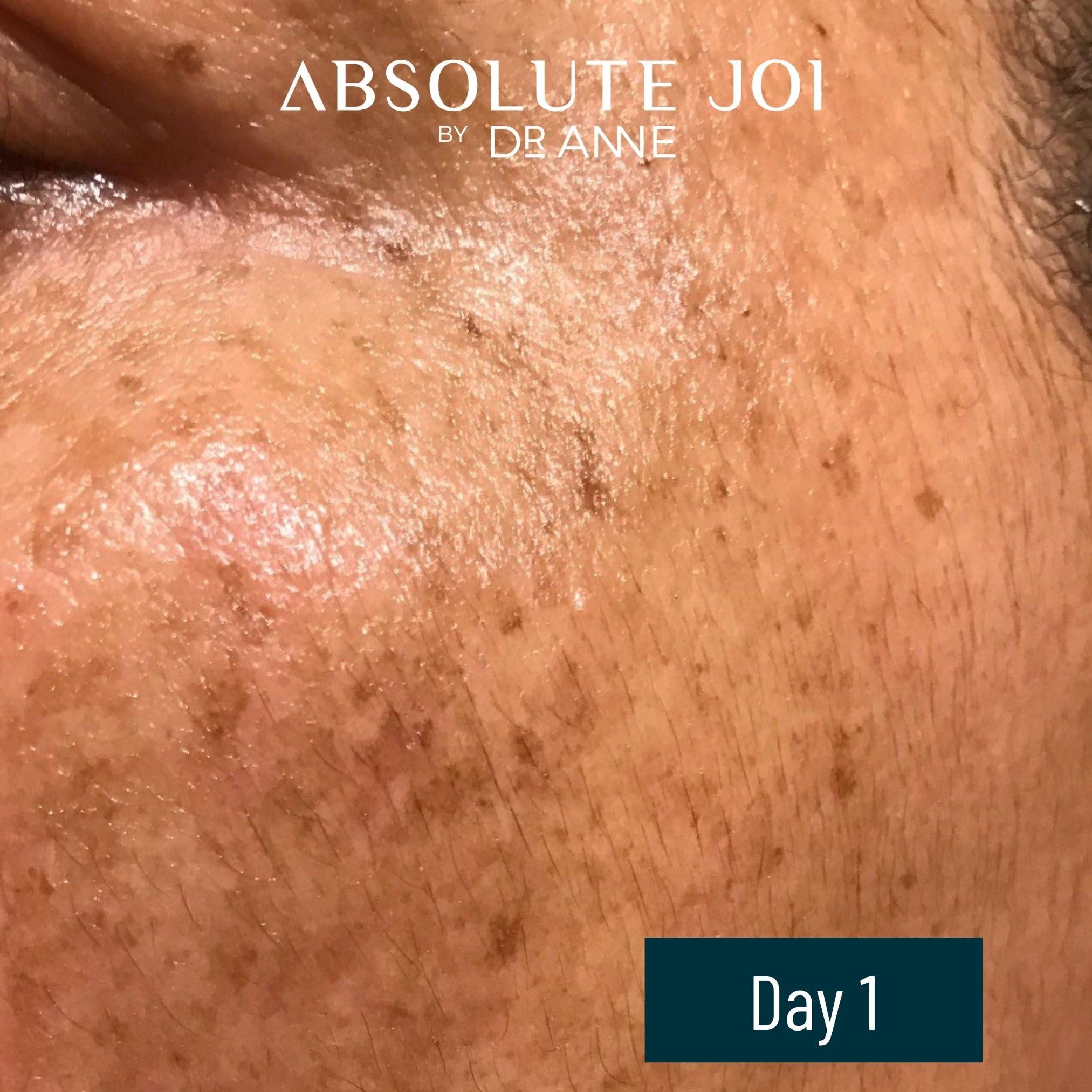 AbsoluteJOI Retinol Plus Vitamin C Skin Refining Night Oil for Fines Lines and Hyperpigmentation with Sensitive Skin Friendly Granactive Retinoid - Unscented - 1 Fl Oz Full Size