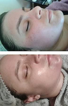 Herbal Power Peel Herbal Power Peel- Chemical & Acid Free Green Herbal Deep Sea Peel-Professional or Home Use