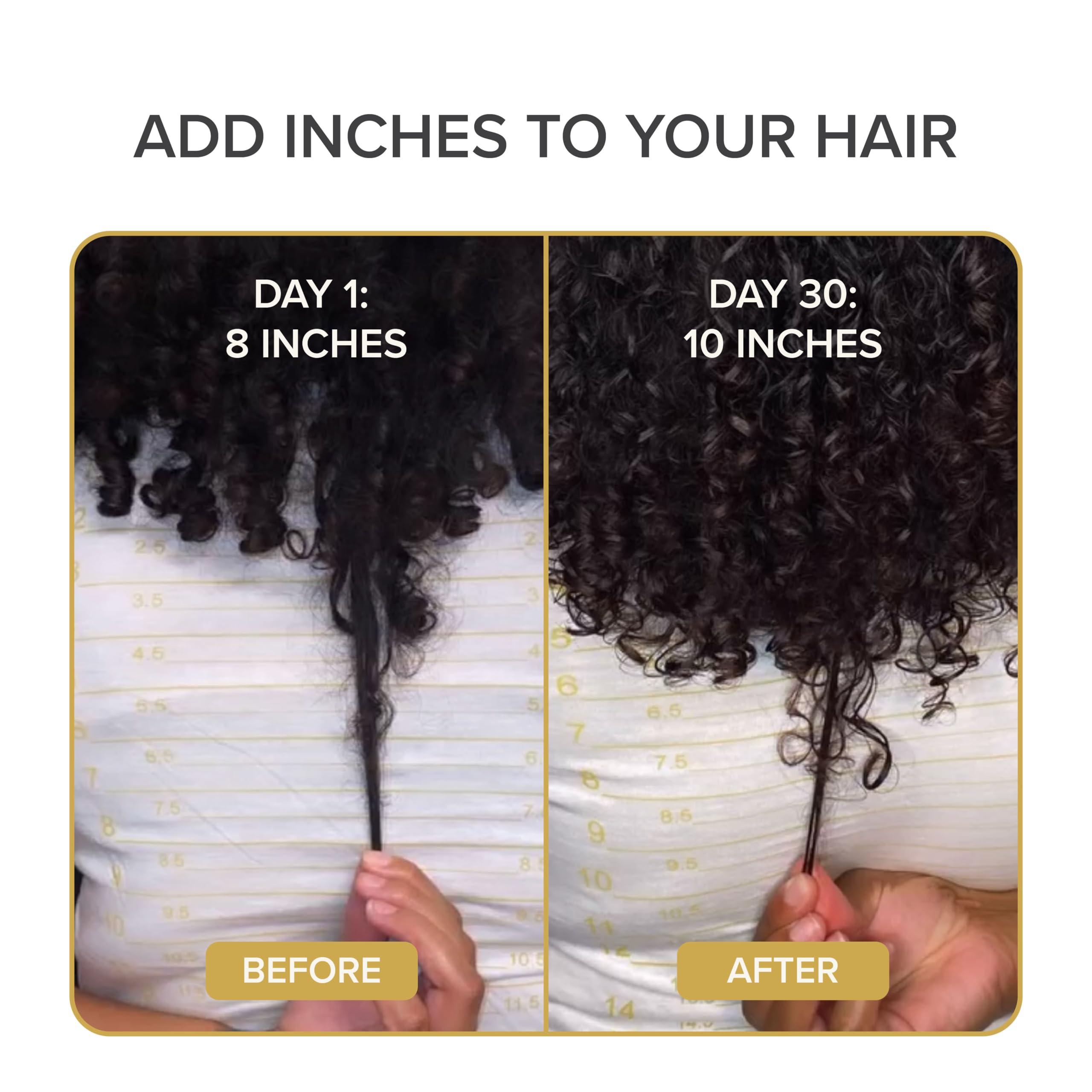 Shedavi Shedavi Iconic Vegan Hair Serum with Botanicals - Growth Treatment for Women & Men\'s Dry, Damaged Hair and Scalp with Argan, Coconut, Castor, and Tea Tree Oils