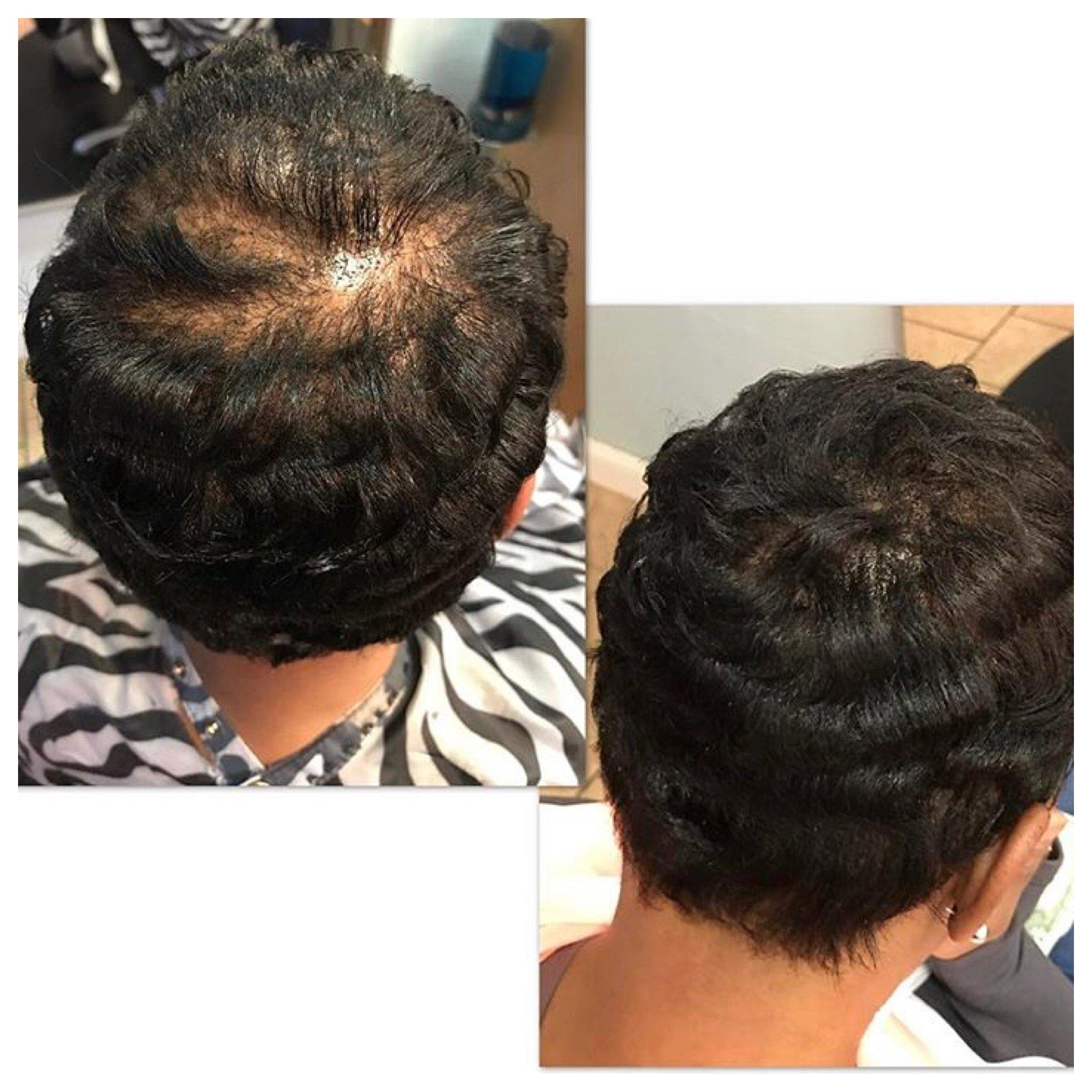 Hair Fusion Hair Fibers for Thinning Hair - (1.05 Oz) Real Human Hair Building Fibers to Conceal Bald Spots and Thinning Hair, Root Touch Up and Volumizer, Brown