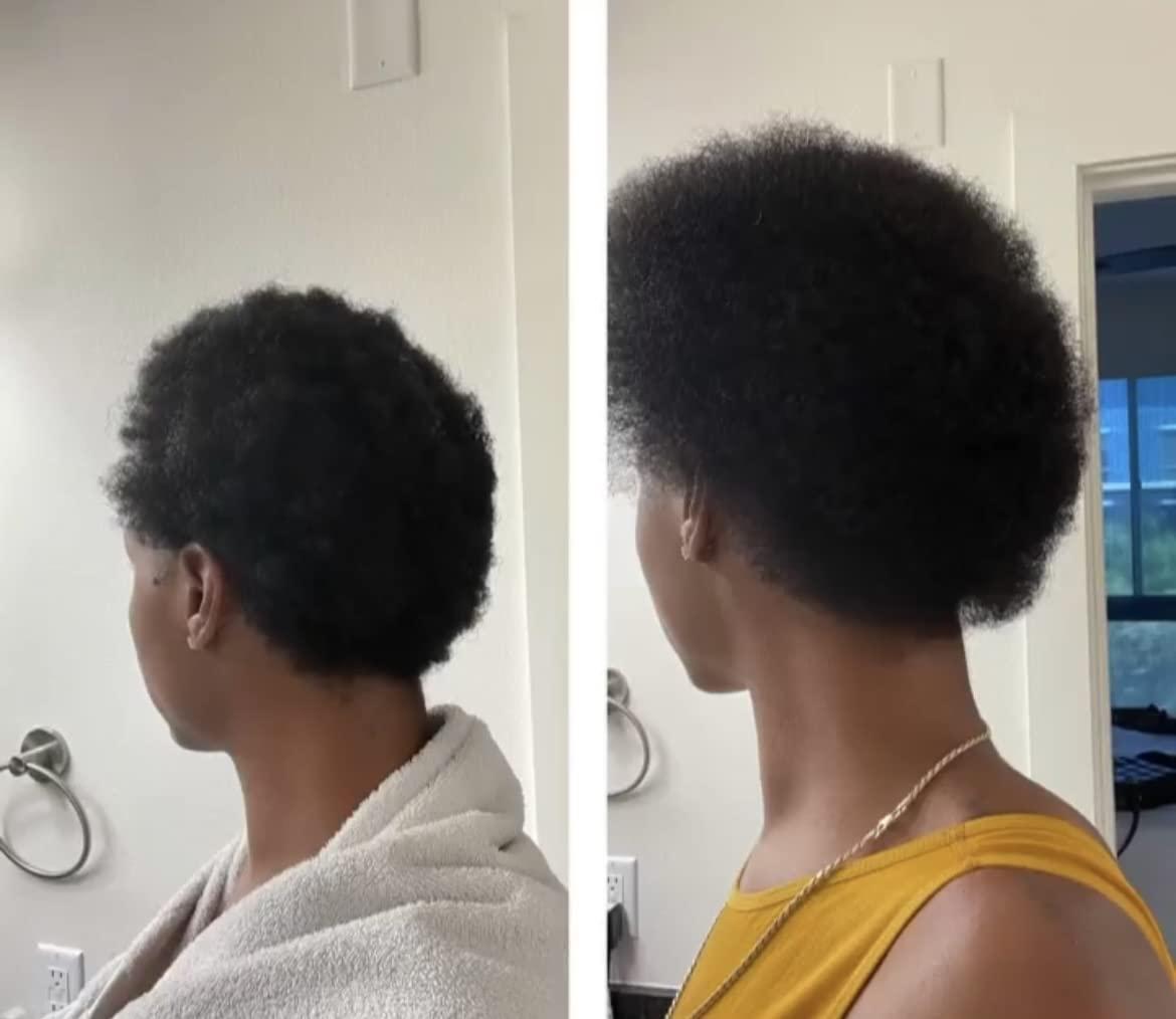 Bur Bur BUR BUR Growing Season Hair Growth And Repair Oil | With Burdock, Nettle Oil and Vitamin C for Visibly Fuller, Stronger and Shinier Hair.