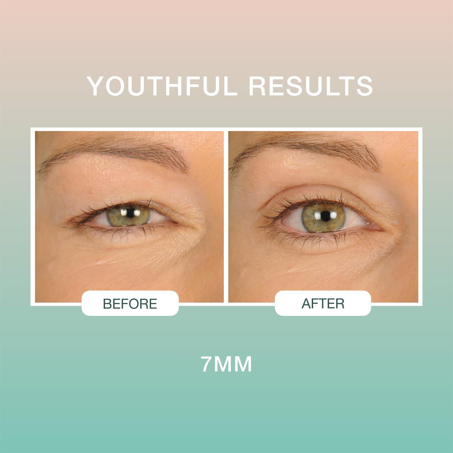 Contours RX Contours Rx Lids By Design - Non-Surgical & Transparent Eyelid Lift Strips - For a More Youthful-Looking Appearance, Reshape and Define with Eyelid Tape for Hooded Eyes (7mm) 80ct