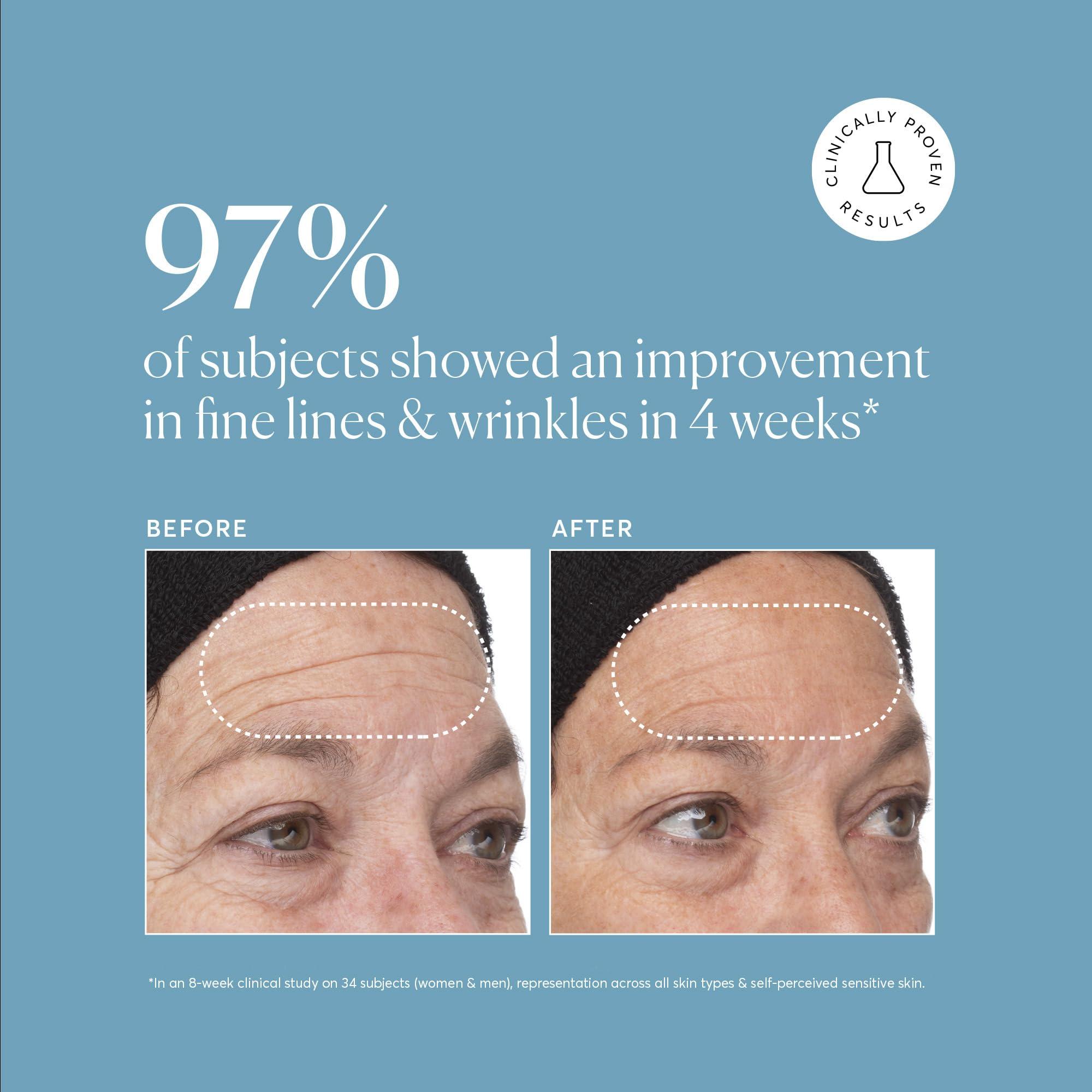 Naturium Naturium Retinol Complex Serum, Encapsulated Retinols & Bakuchiol, Refining & Smoothing Facial Serum, 1 oz