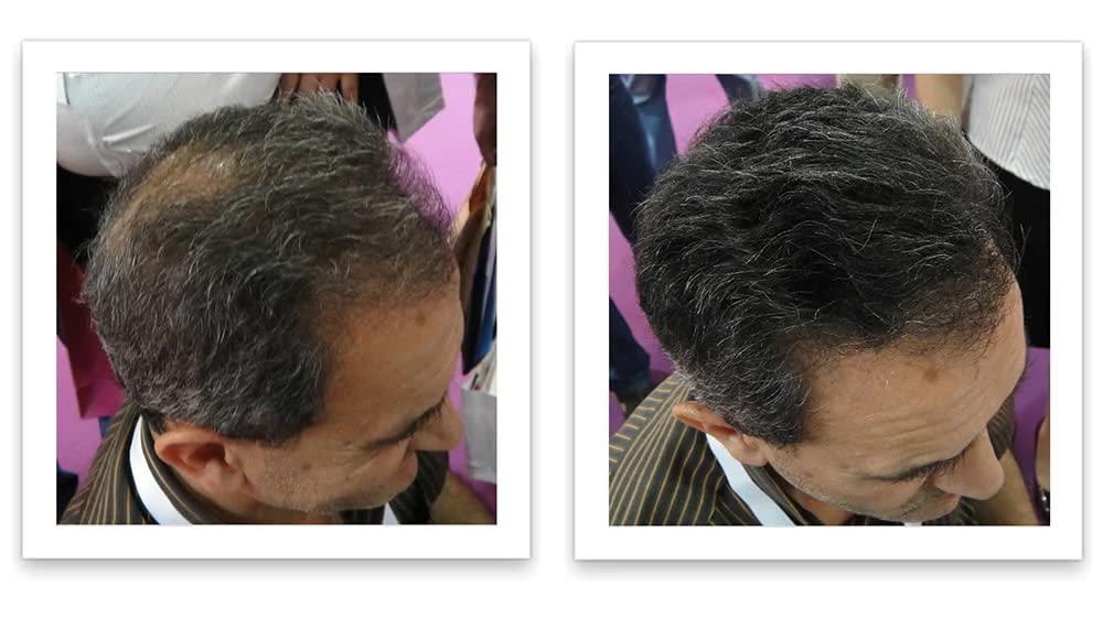 Caboki CABOKI VALUE PACK 1, 2x30G Hair Building Fiber Plus Hair Fiber Spray. 180-Day supply, Salt & Pepper Dark