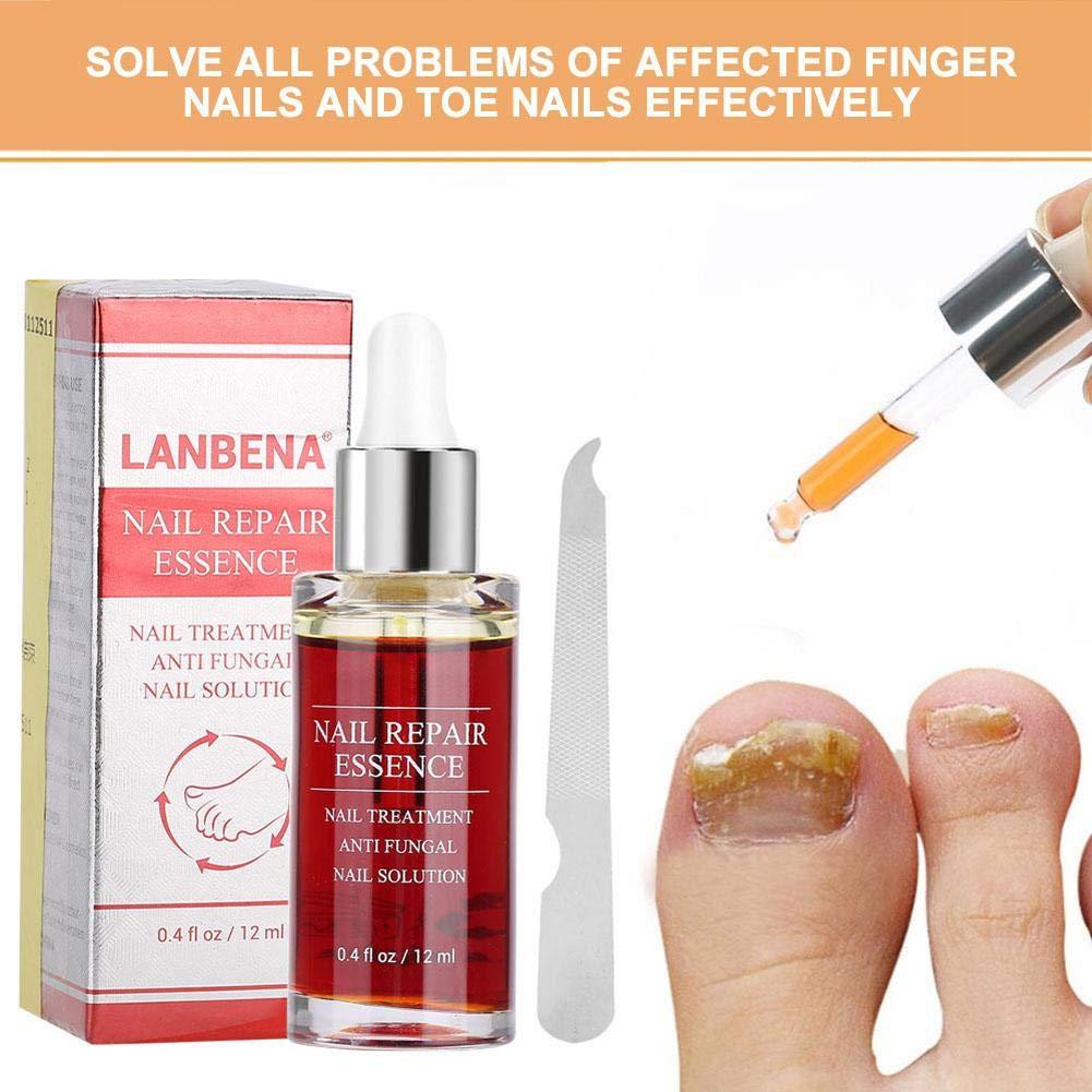 Salmue 12 ml Nail Care Solution Set, Powerful Nail Repair Essence, Nail Care Solution with Nail File, Nail Care Tool, Anti- Nail Treatment Effective Repair Solution