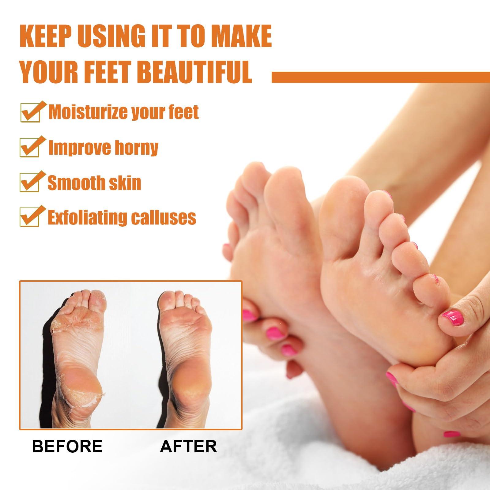 LOEBKE Foot Callus Removal Spray,Foot Heel Callus Remover Spray,Foot Peeling Spray Orange Oil,Foot Peel Spray That Remove Dead Skin,Exfoliating Peeling & Calluses On Feet (1PCS)